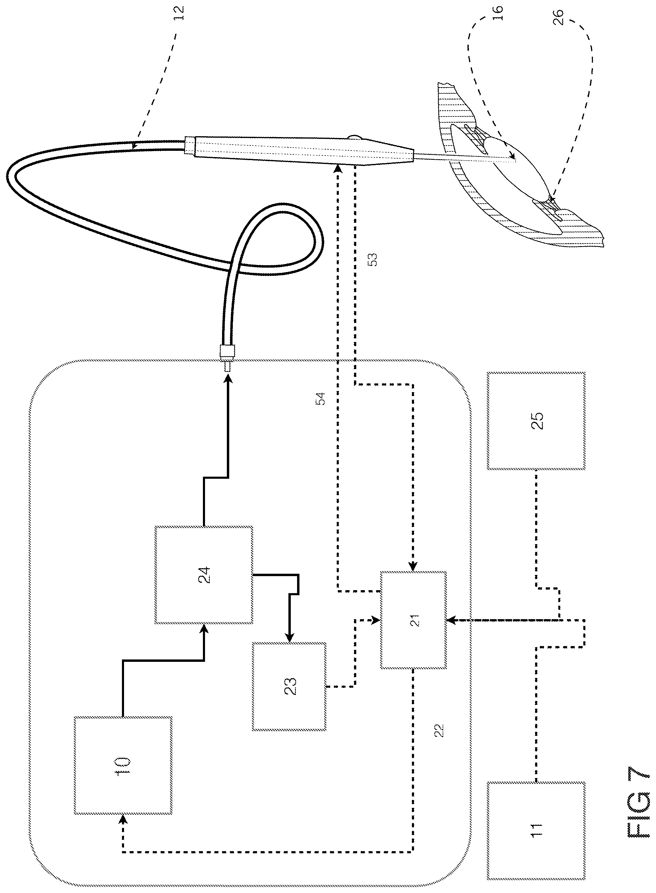 Patent US12396891 Figure 7 – Laser apparatus for treatment of a cataractous lens