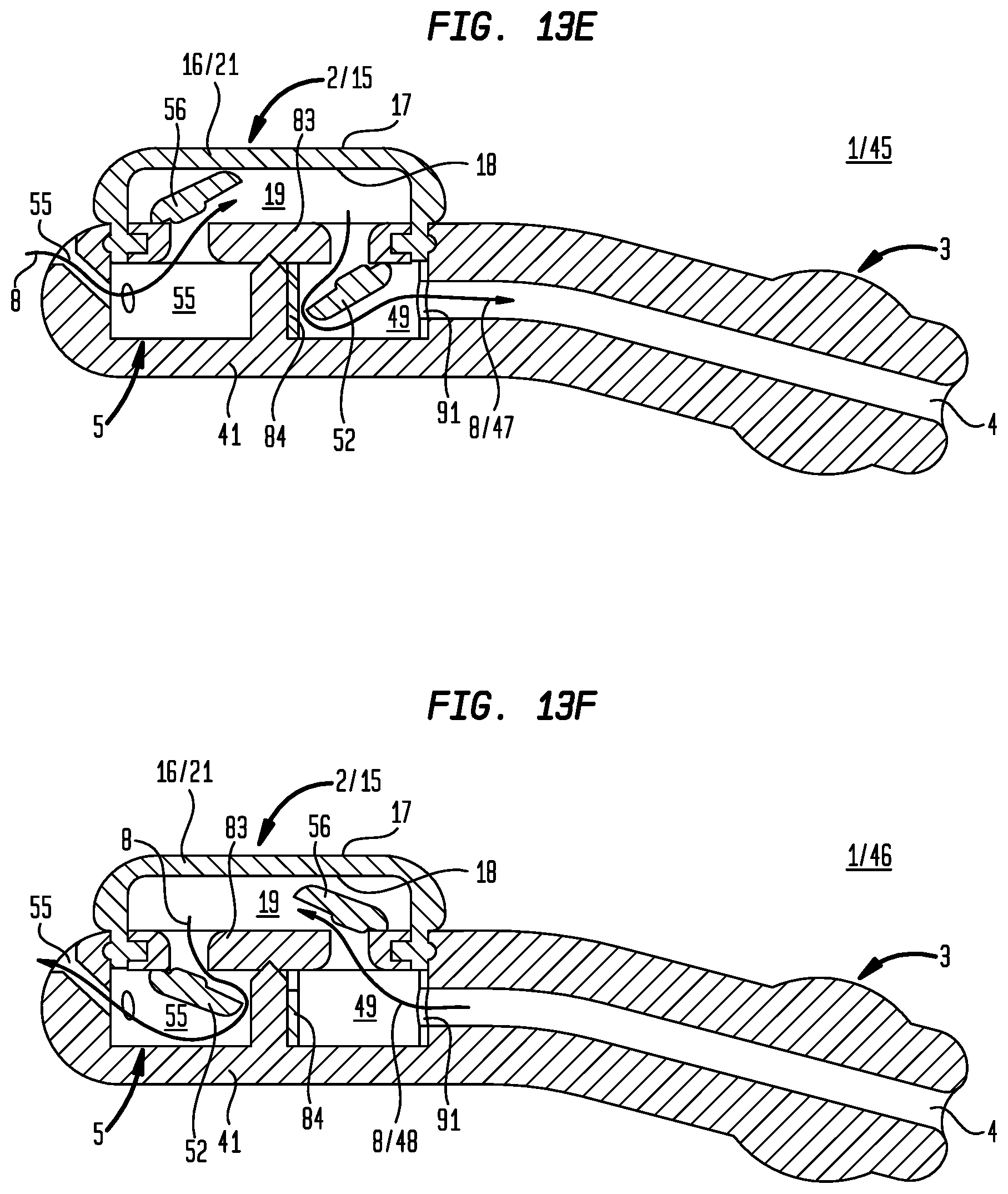 Patent US12396892 Figure 15 – External ear canal pressure regulation device