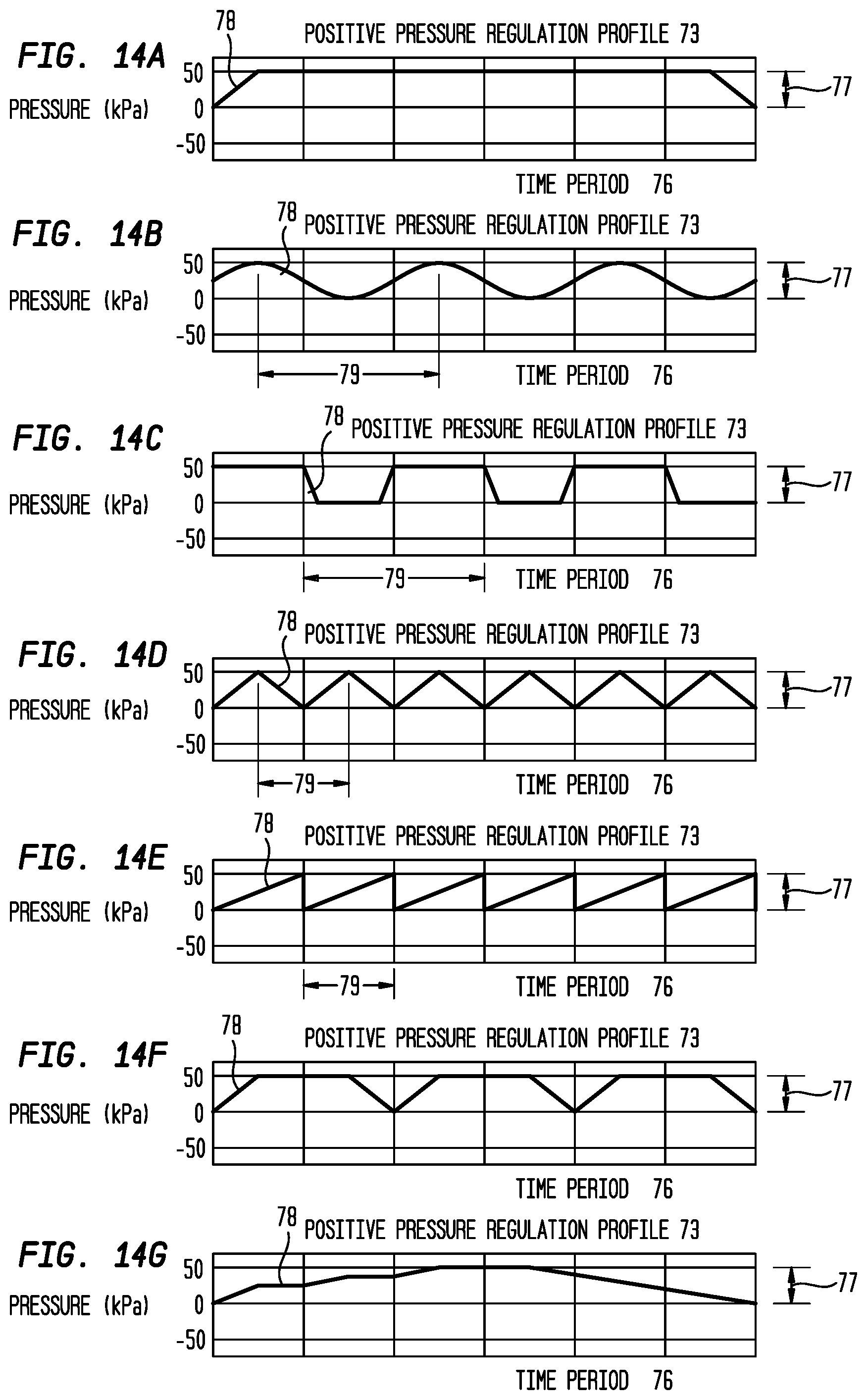Patent US12396892 Figure 16 – External ear canal pressure regulation device