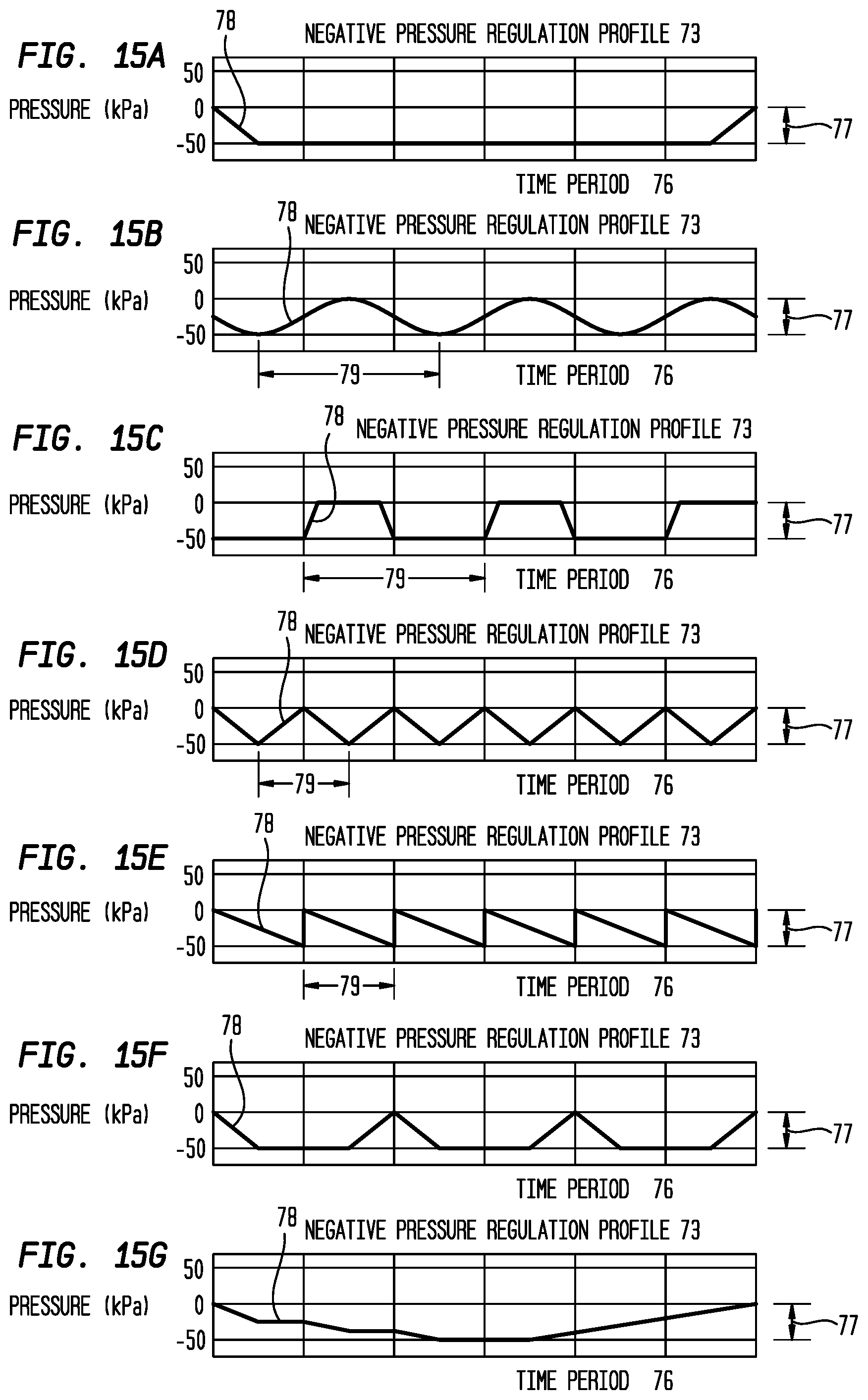 Patent US12396892 Figure 17 – External ear canal pressure regulation device