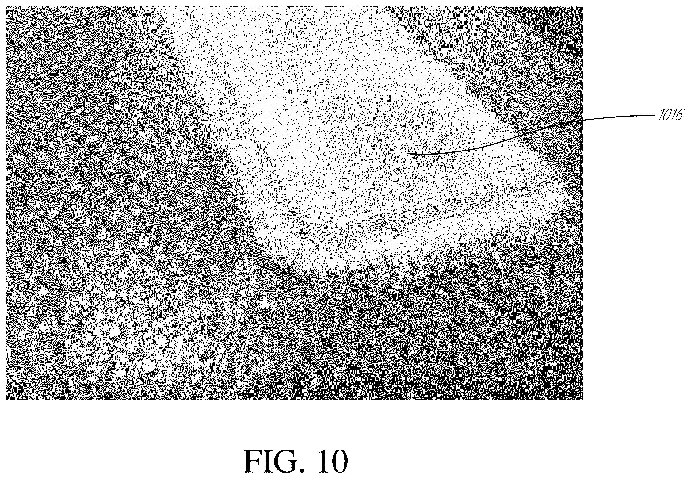 Patent US12396895 Figure 10 – Wound treatment apparatuses and methods with negative pressure source integrated into wound dressing
