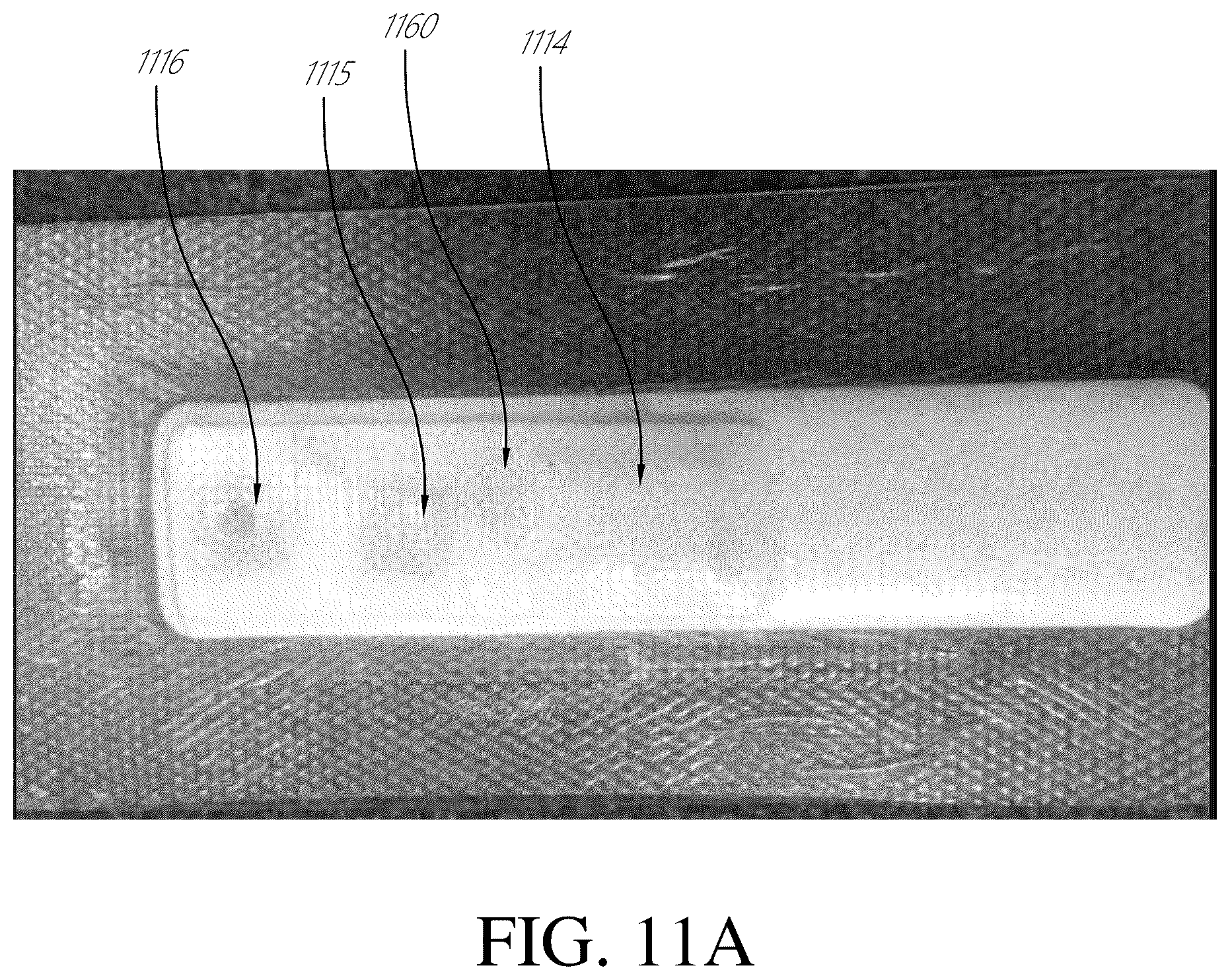 Patent US12396895 Figure 11 – Wound treatment apparatuses and methods with negative pressure source integrated into wound dressing