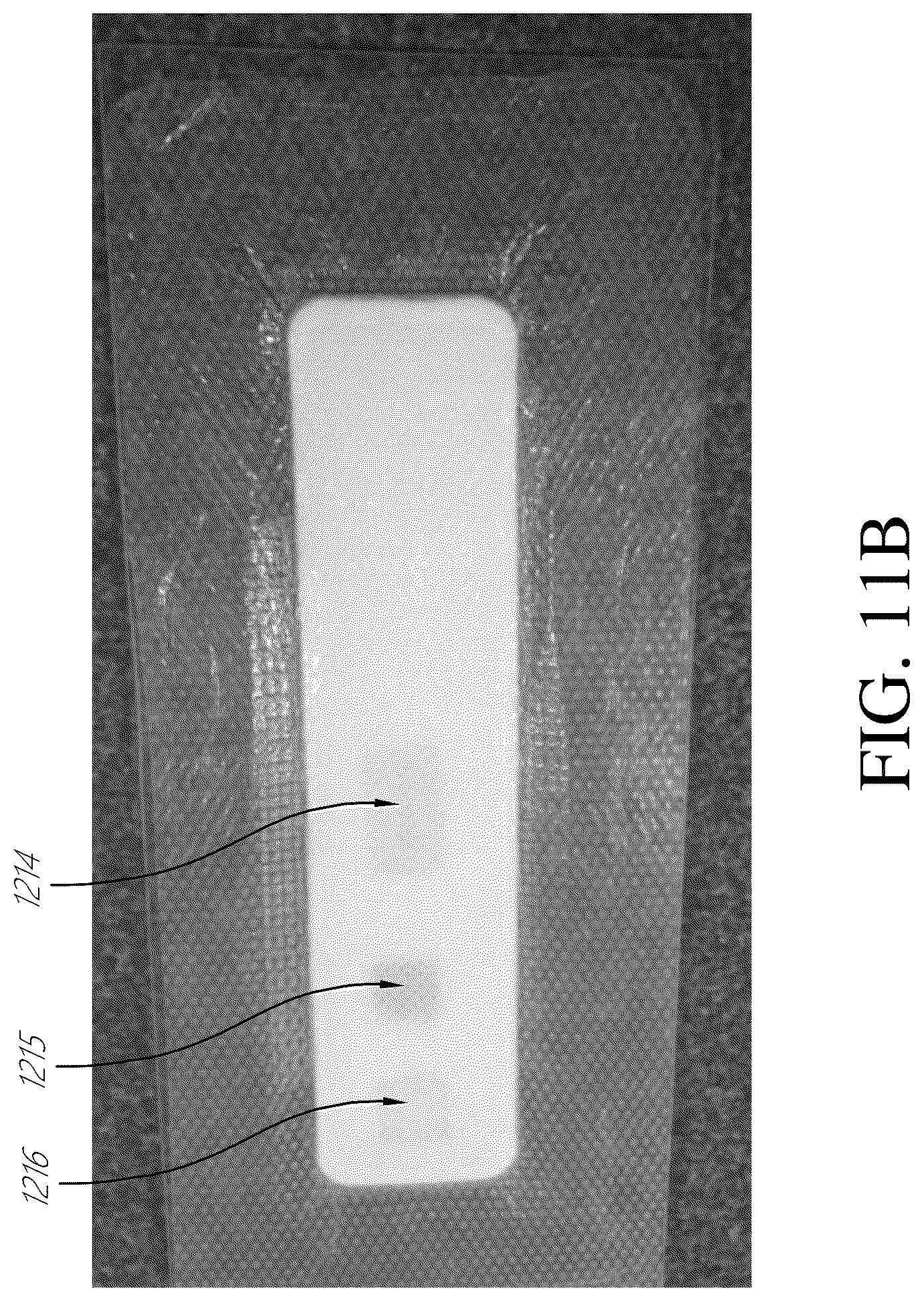 Patent US12396895 Figure 12 – Wound treatment apparatuses and methods with negative pressure source integrated into wound dressing