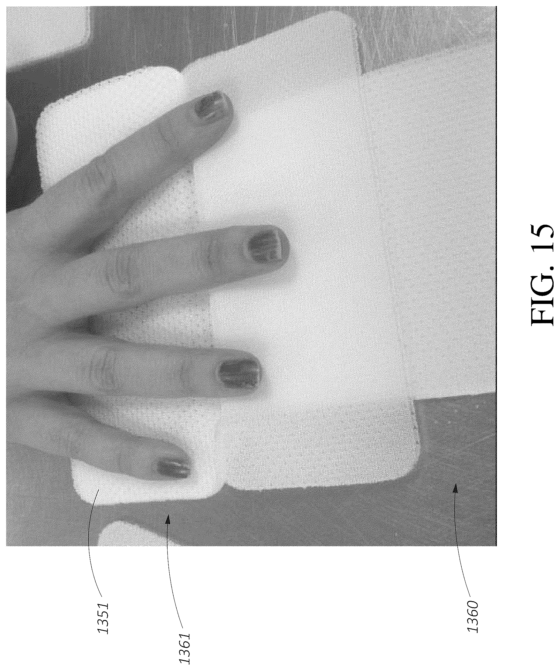 Patent US12396895 Figure 18 – Wound treatment apparatuses and methods with negative pressure source integrated into wound dressing