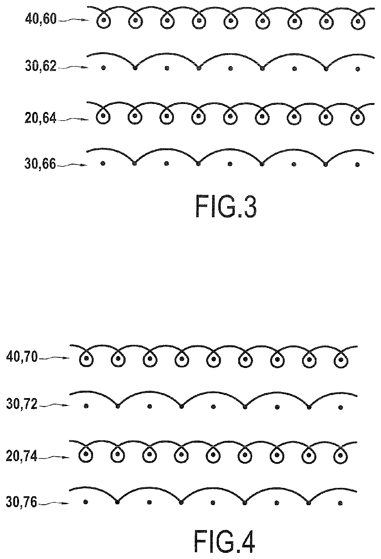 Patent US12396896 Figure 2 – Compression garment that is easy to slip on/off