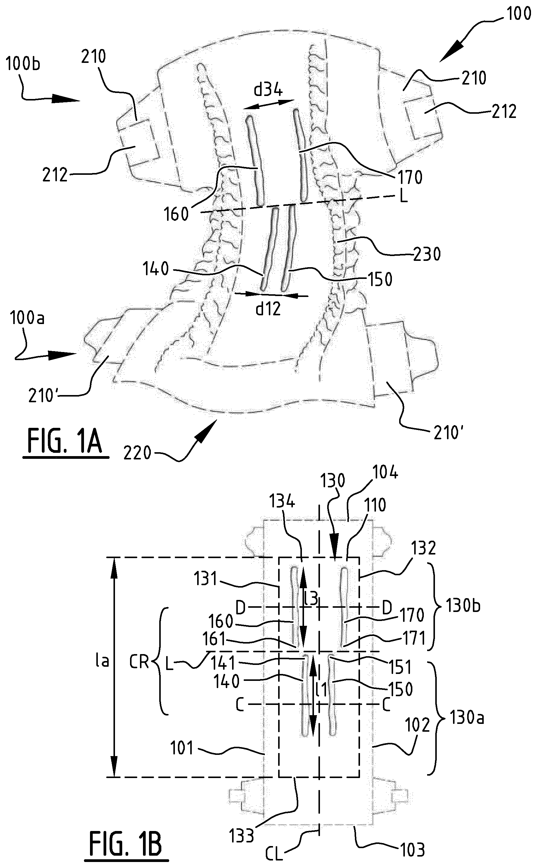 Patent US12396897 Figure 1 – Absorbent article with channels and method for manufacturing thereof