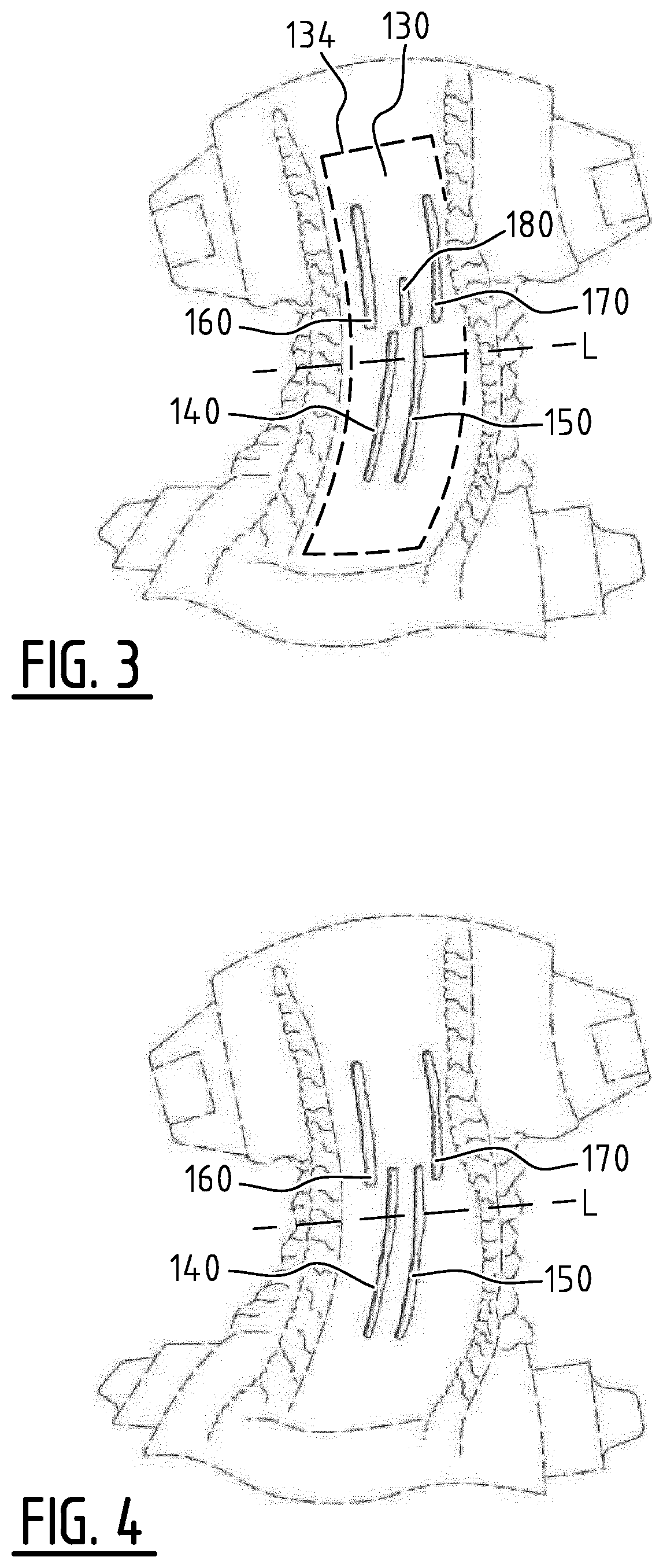 Patent US12396897 Figure 4 – Absorbent article with channels and method for manufacturing thereof