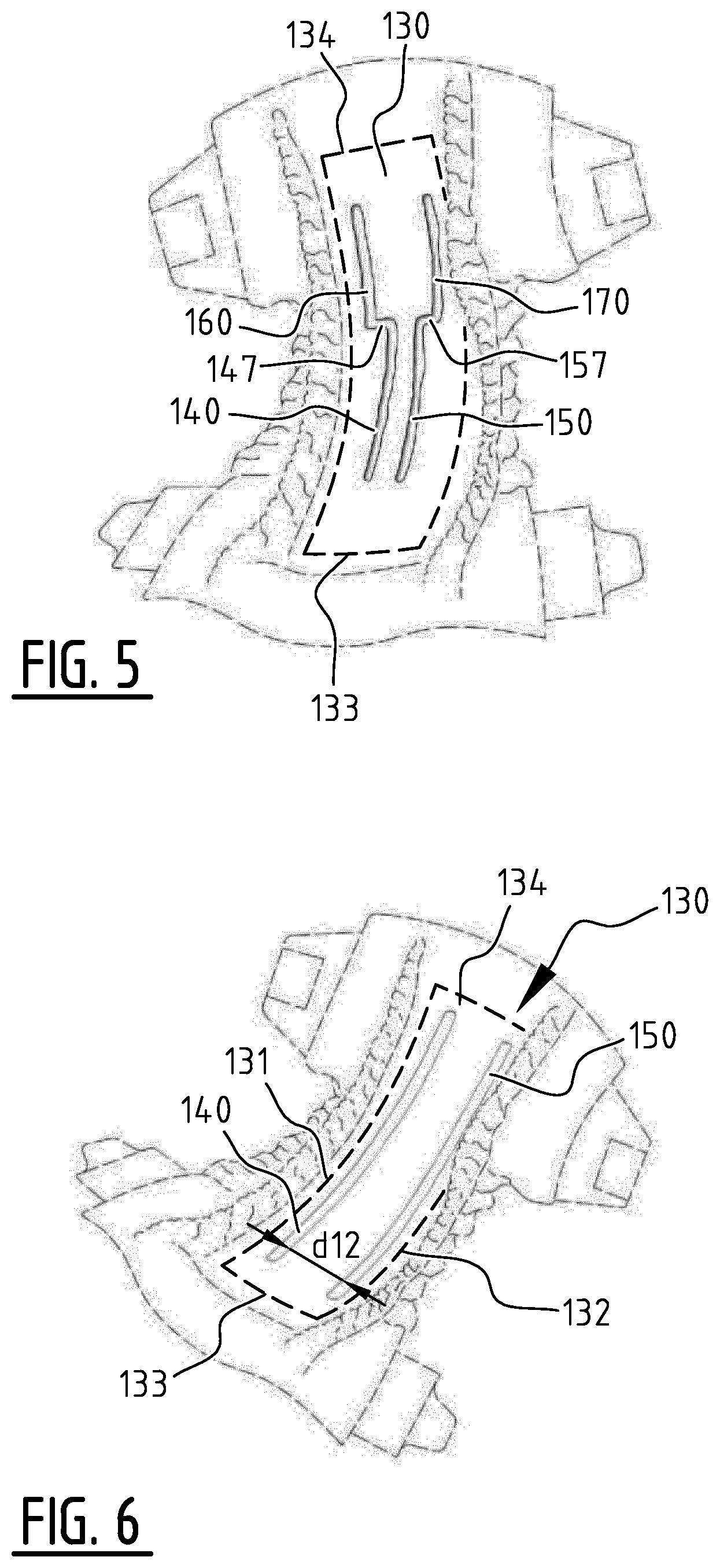 Patent US12396897 Figure 5 – Absorbent article with channels and method for manufacturing thereof