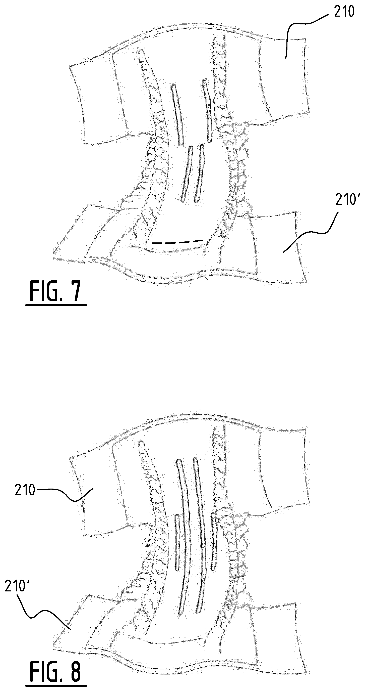 Patent US12396897 Figure 6 – Absorbent article with channels and method for manufacturing thereof