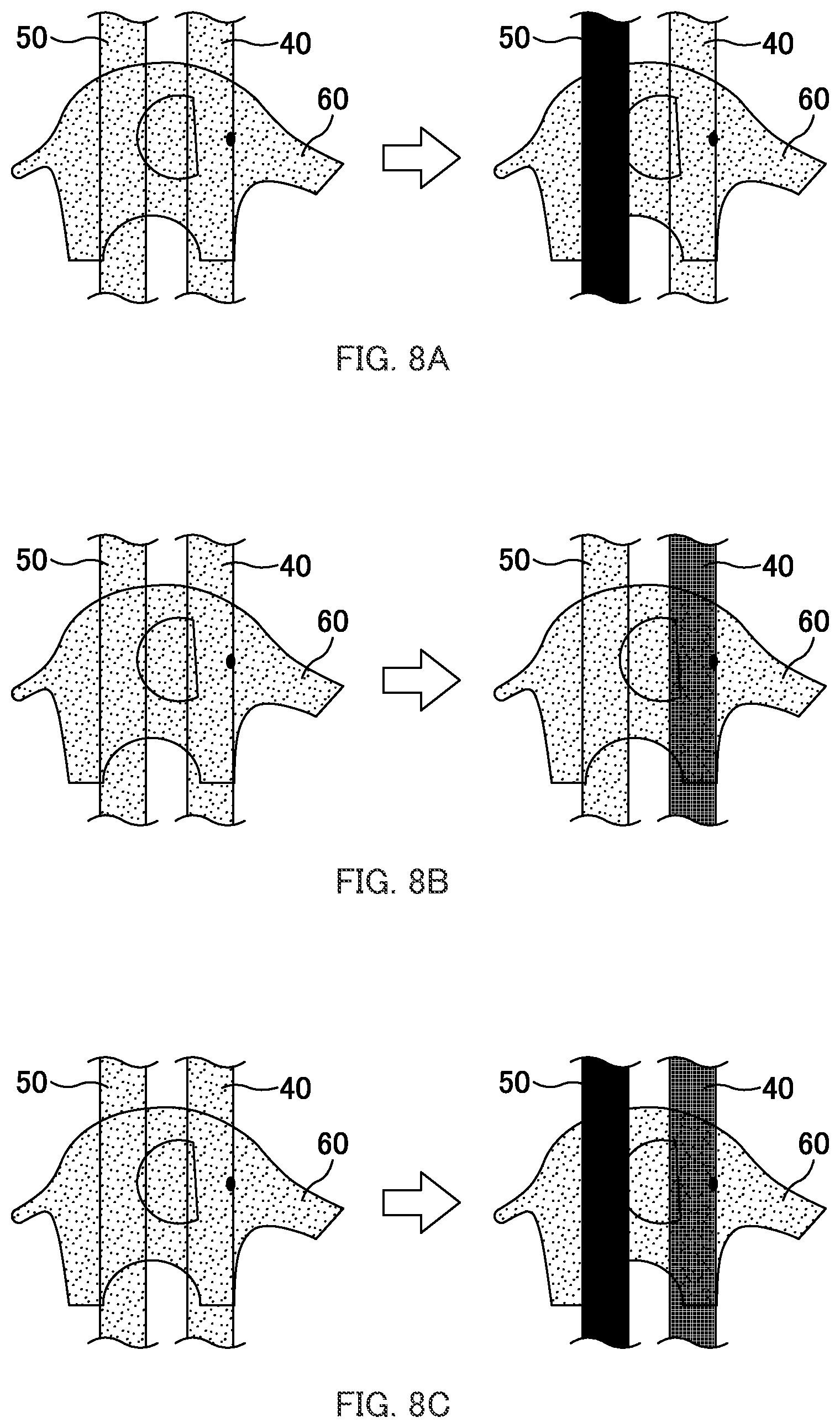 Patent US12396899 Figure 6 – Absorbent product provided with feces indicator and urine indicator