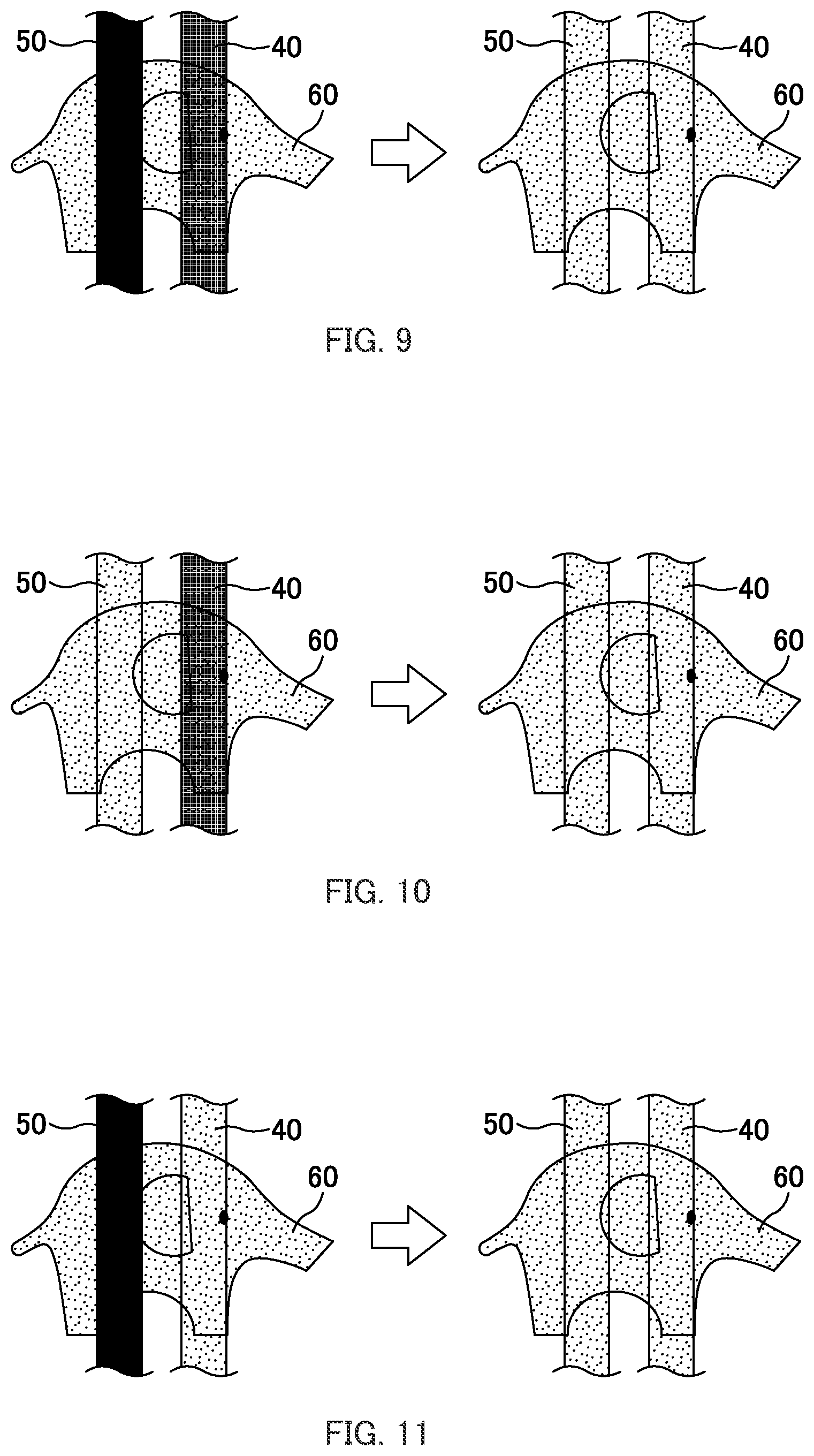 Patent US12396899 Figure 7 – Absorbent product provided with feces indicator and urine indicator