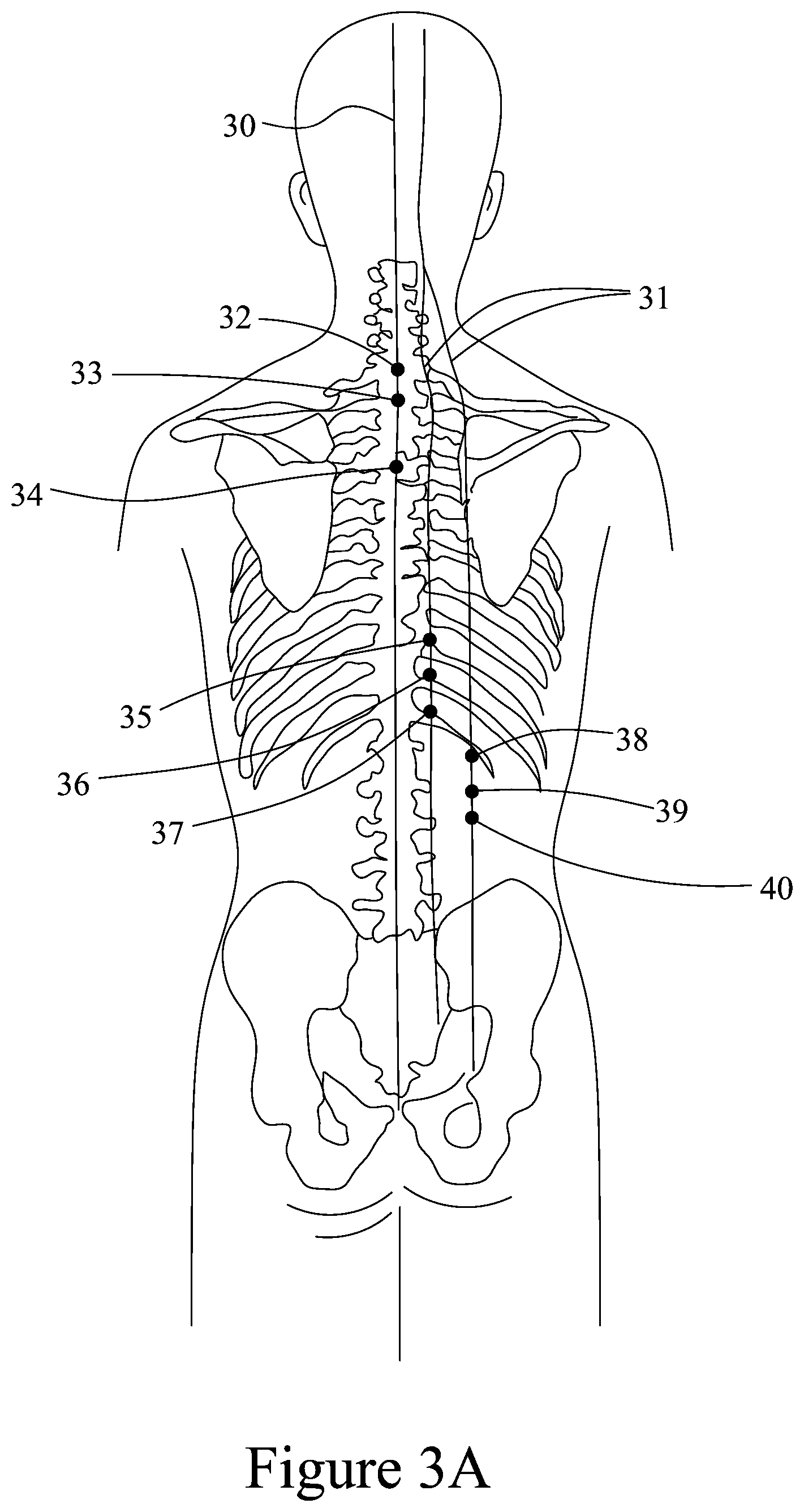 Patent US12396922 Figure 3 – Device, body, method and system for health-care