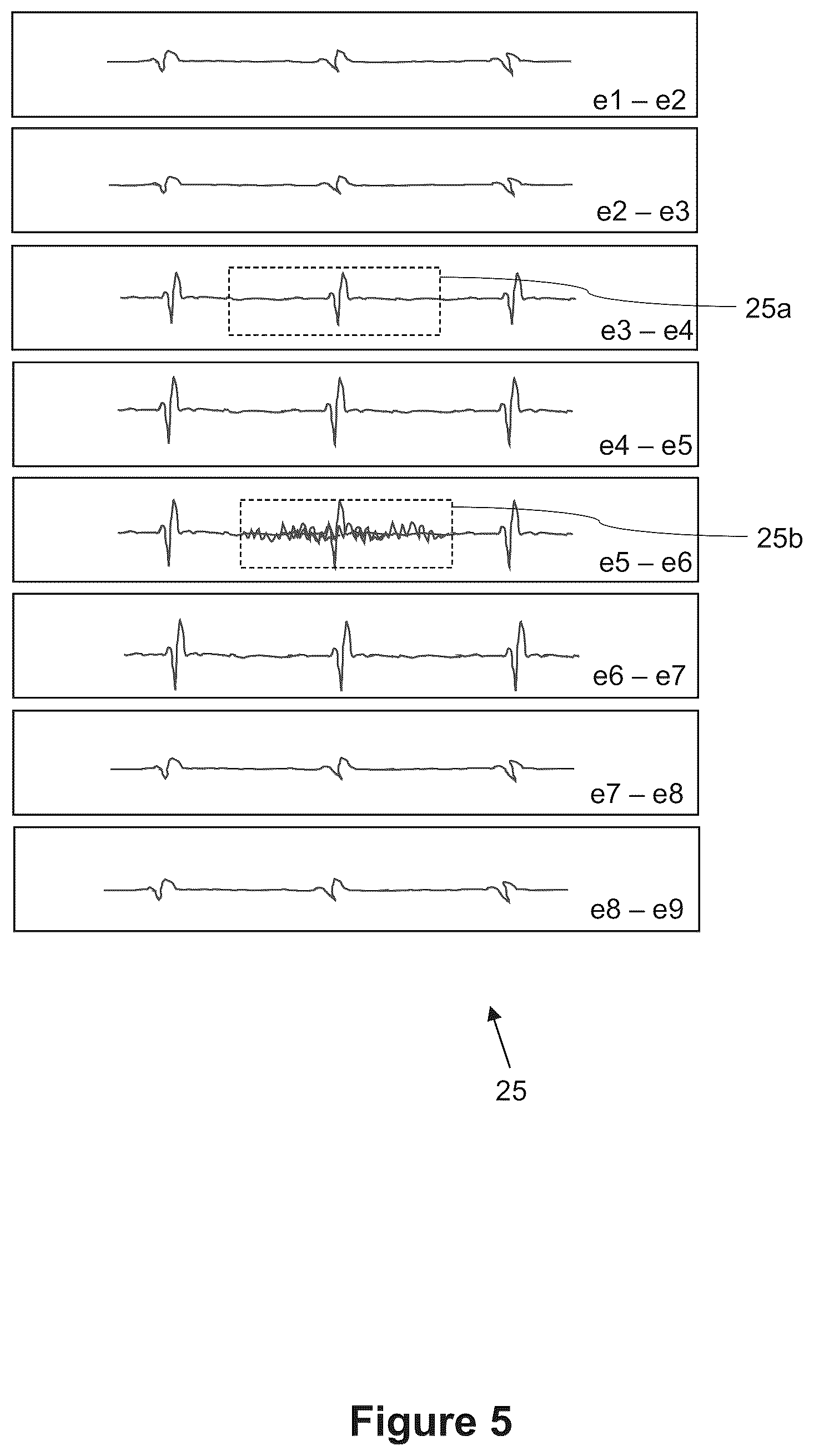 Patent US12396927 Figure 5 – Classifying of a position of a catheter in relation to a diaphragm