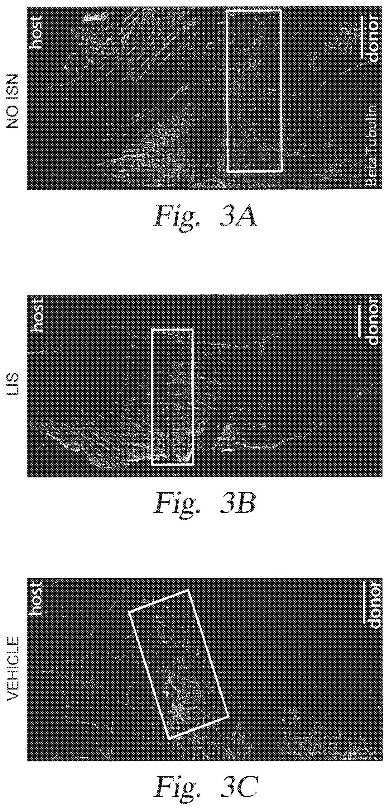 Patent US12396950 Figure 4 – Localized immunosuppression of allografts for peripheral nerve repair