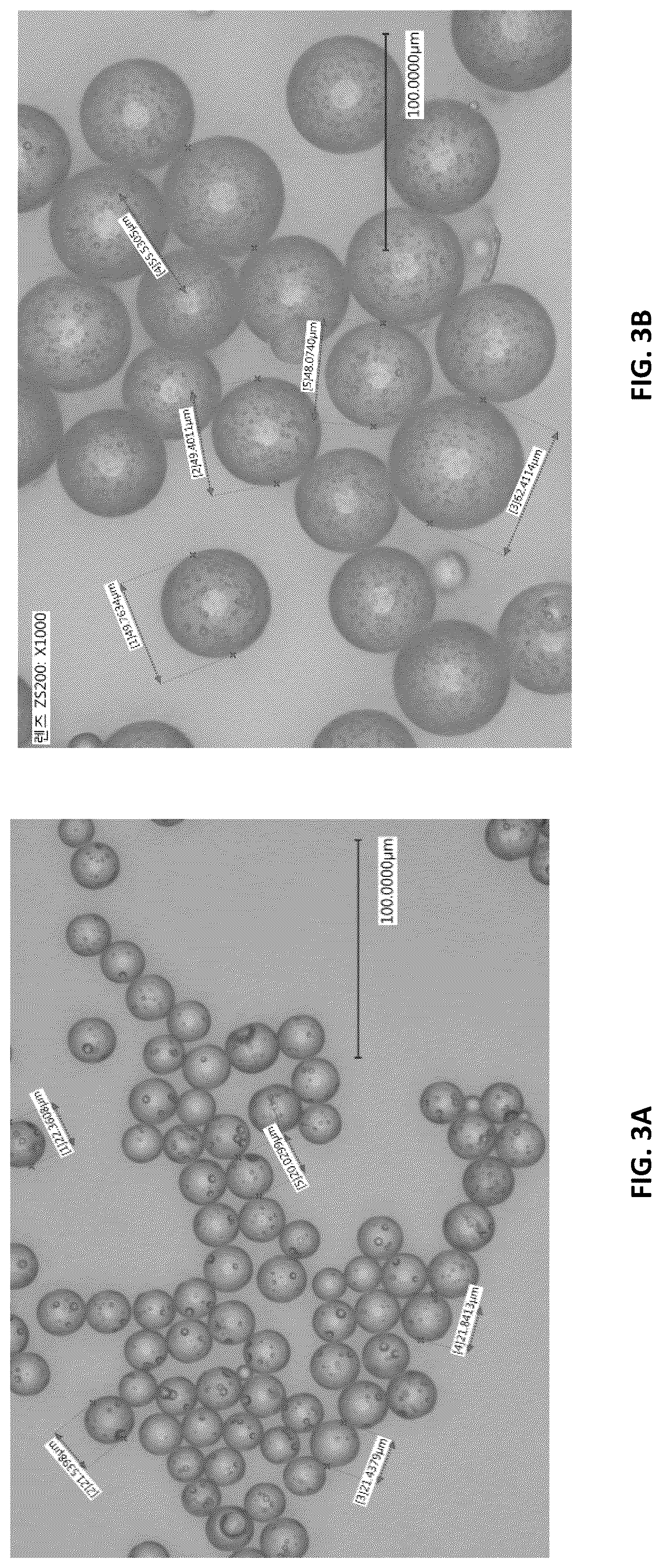 Patent US12396951 Figure 4 – Prevention of local tumor recurrence following surgery using sustainedand/or delayed release of medicaments contained in micro-particles