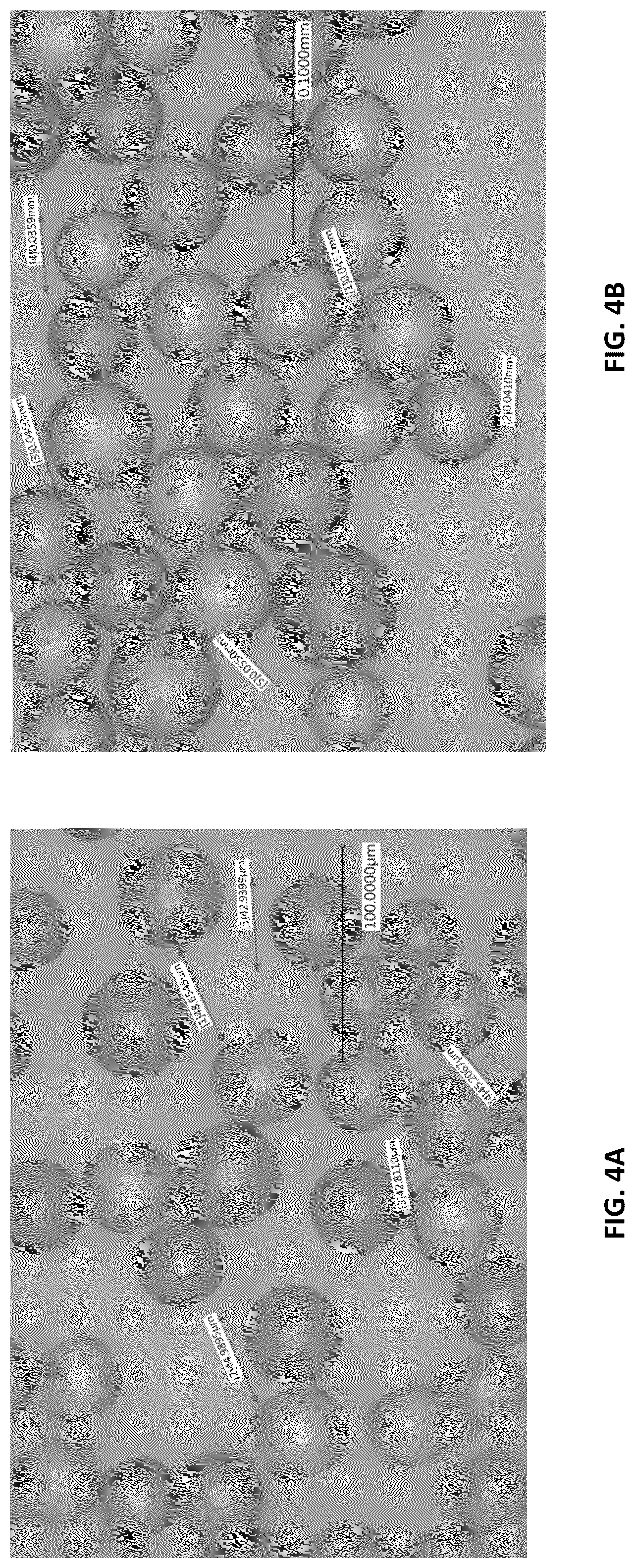 Patent US12396951 Figure 5 – Prevention of local tumor recurrence following surgery using sustainedand/or delayed release of medicaments contained in micro-particles
