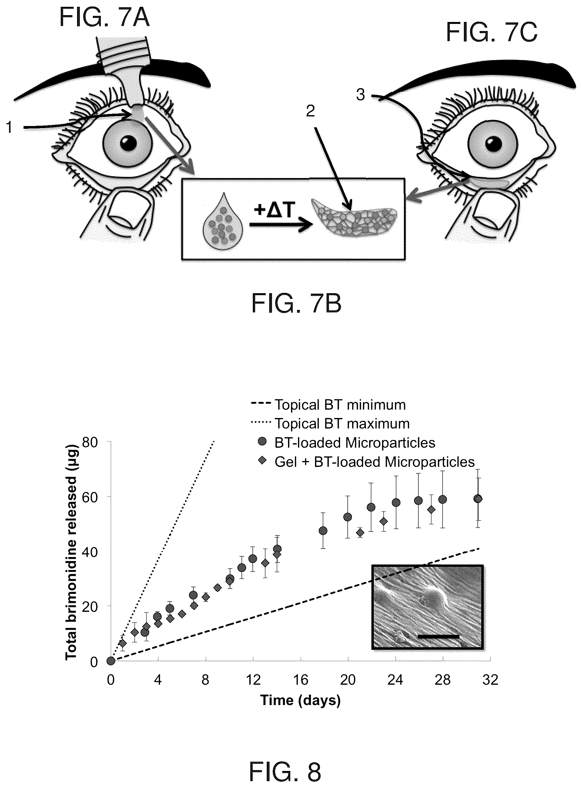 Patent US12396959 Figure 6 – Thermoresponsive hydrogel containing polymer microparticles for noninvasive ocular drug delivery