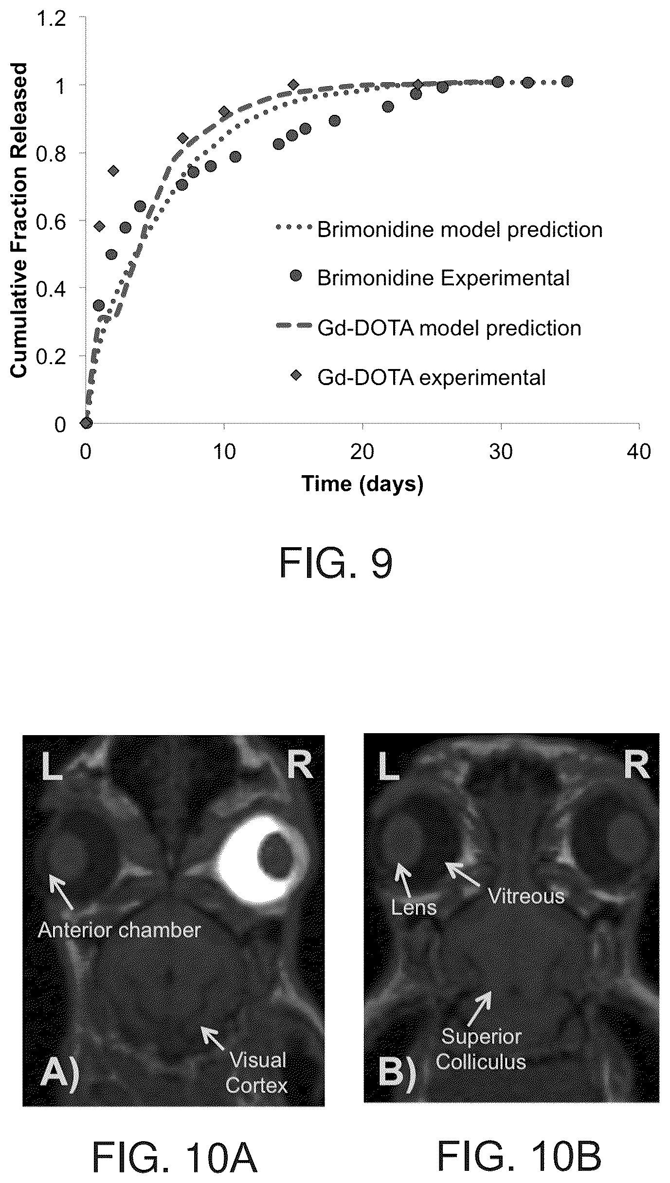 Patent US12396959 Figure 7 – Thermoresponsive hydrogel containing polymer microparticles for noninvasive ocular drug delivery