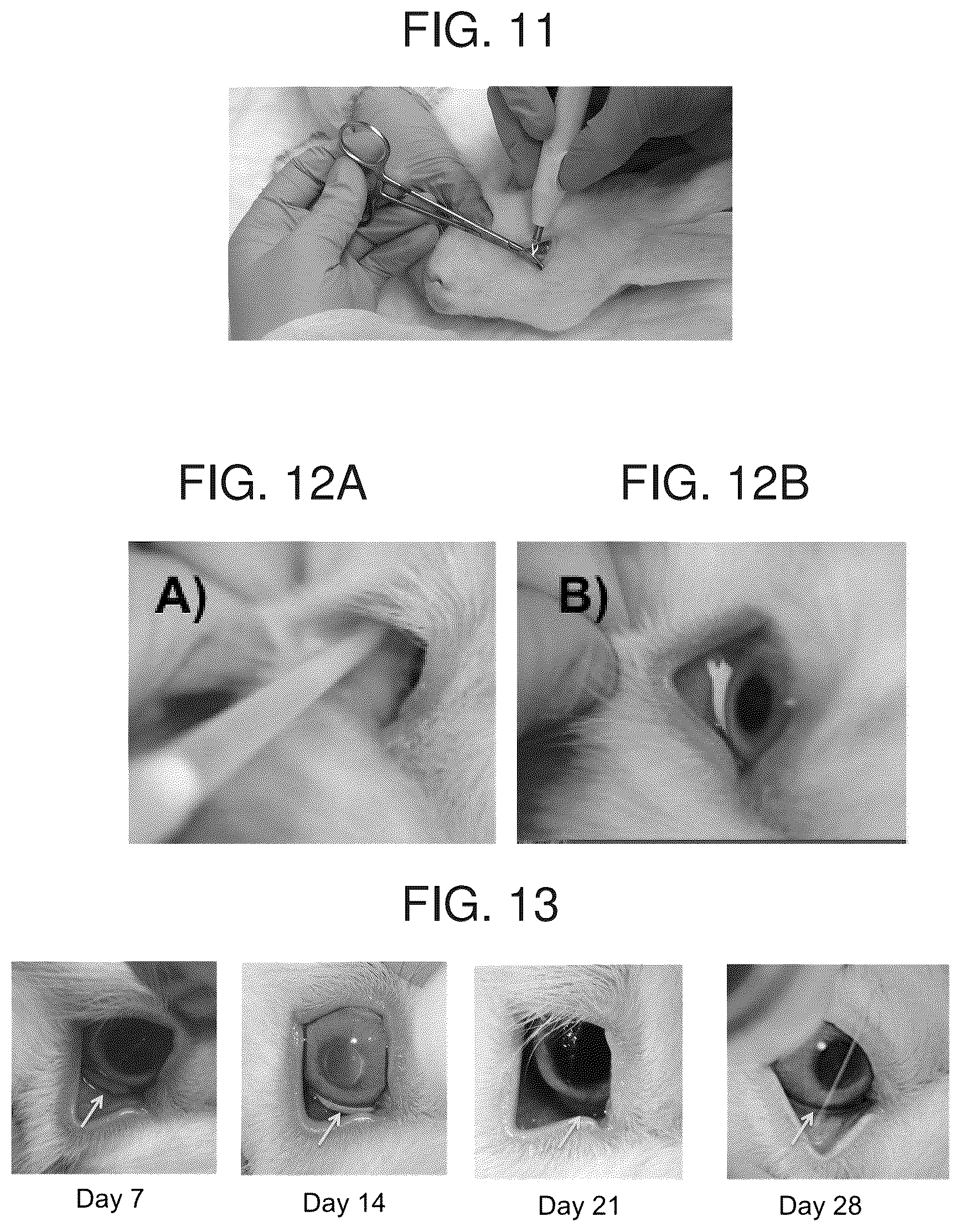 Patent US12396959 Figure 8 – Thermoresponsive hydrogel containing polymer microparticles for noninvasive ocular drug delivery