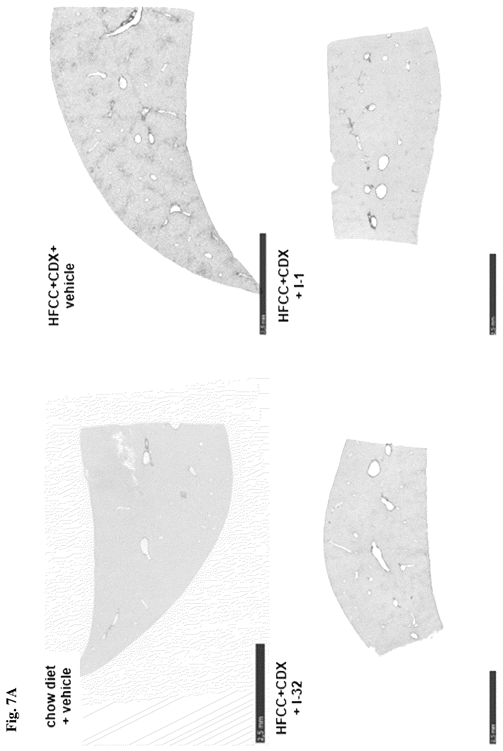 Patent US12396972 Figure 11 – Functionalized long-chain hydrocarbon mono- and di-carboxylic acids and derivatives thereof, and their use for the prevention or treatment of disease