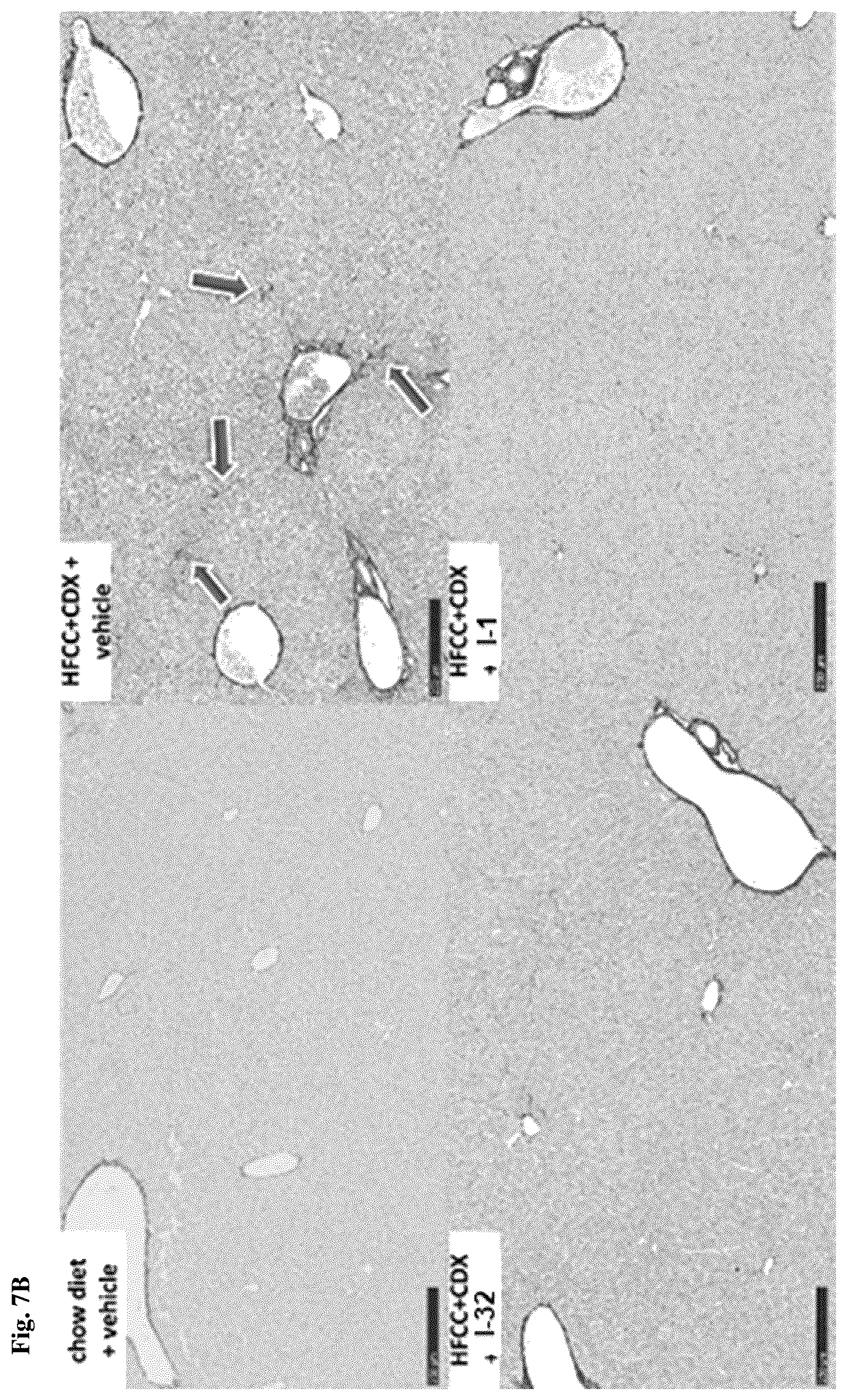 Patent US12396972 Figure 12 – Functionalized long-chain hydrocarbon mono- and di-carboxylic acids and derivatives thereof, and their use for the prevention or treatment of disease