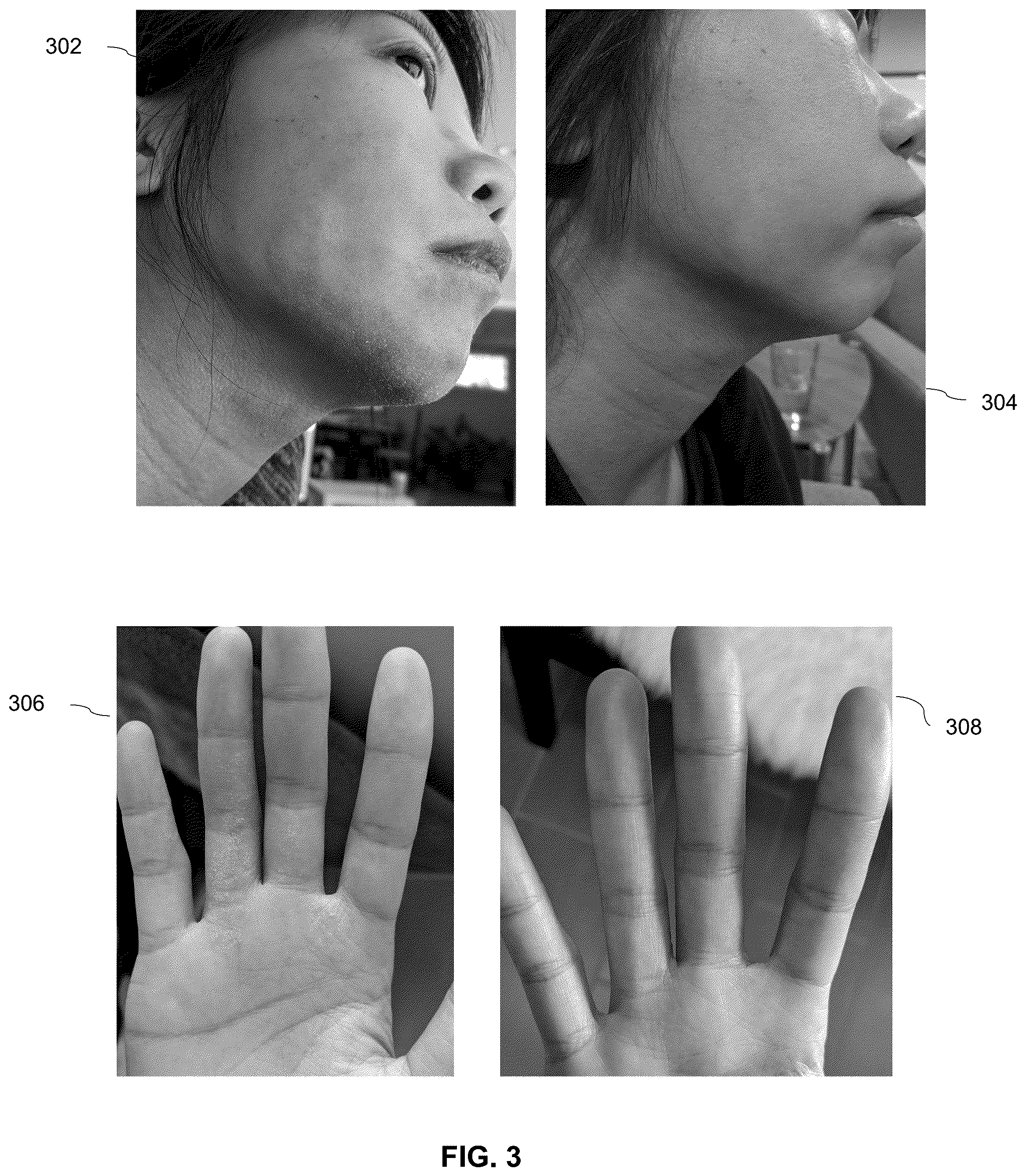 Patent US12396973 Figure 4 – Methods and chemical compositions for treating skin conditions by providing long lasting skin PH control for improving skin barrier function