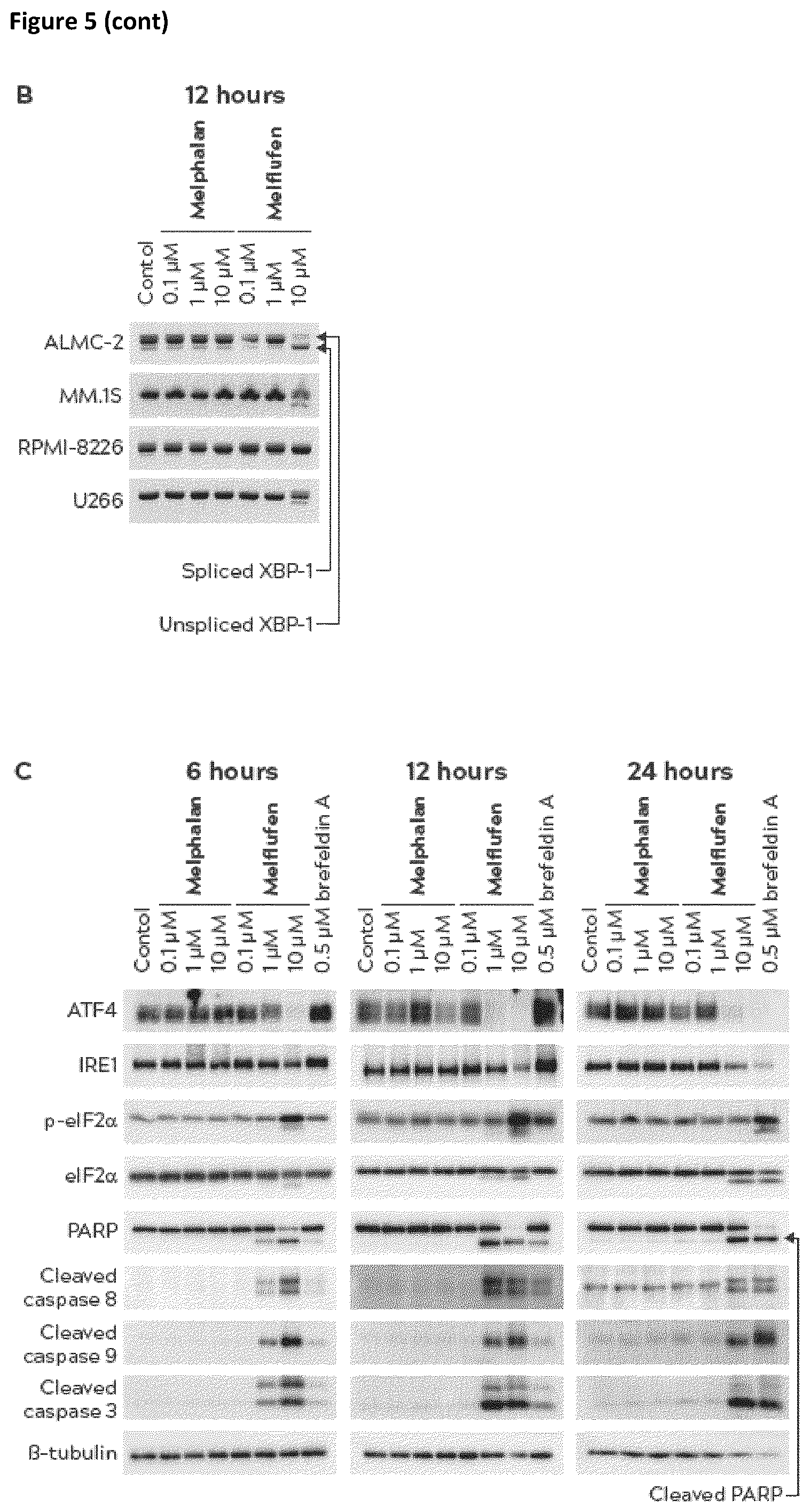 Patent US12396975 Figure 6 – Treatment of al amyloidosis with melflufen