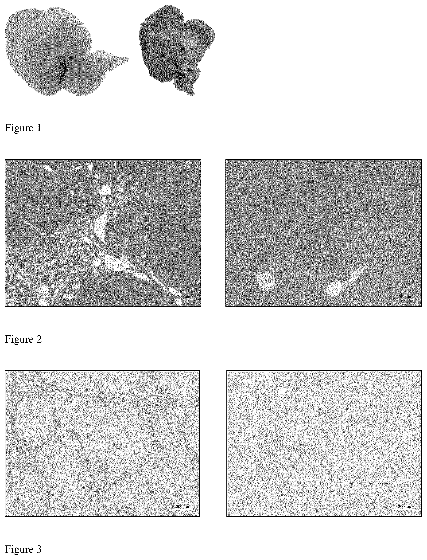 Patent US12396990 — Application of 5-hydroxytryptamine receptor 1A in preparing drug for portal hypertension — Figure 1