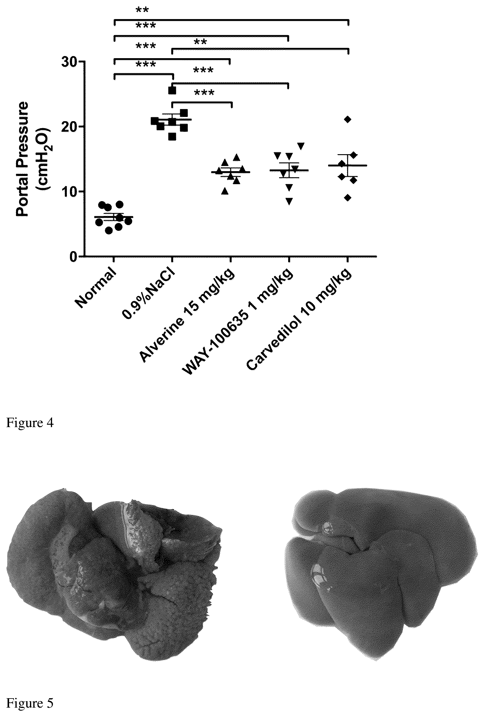 Patent US12396990 Figure 2 – Application of 5-hydroxytryptamine receptor 1A in preparing drug for portal hypertension