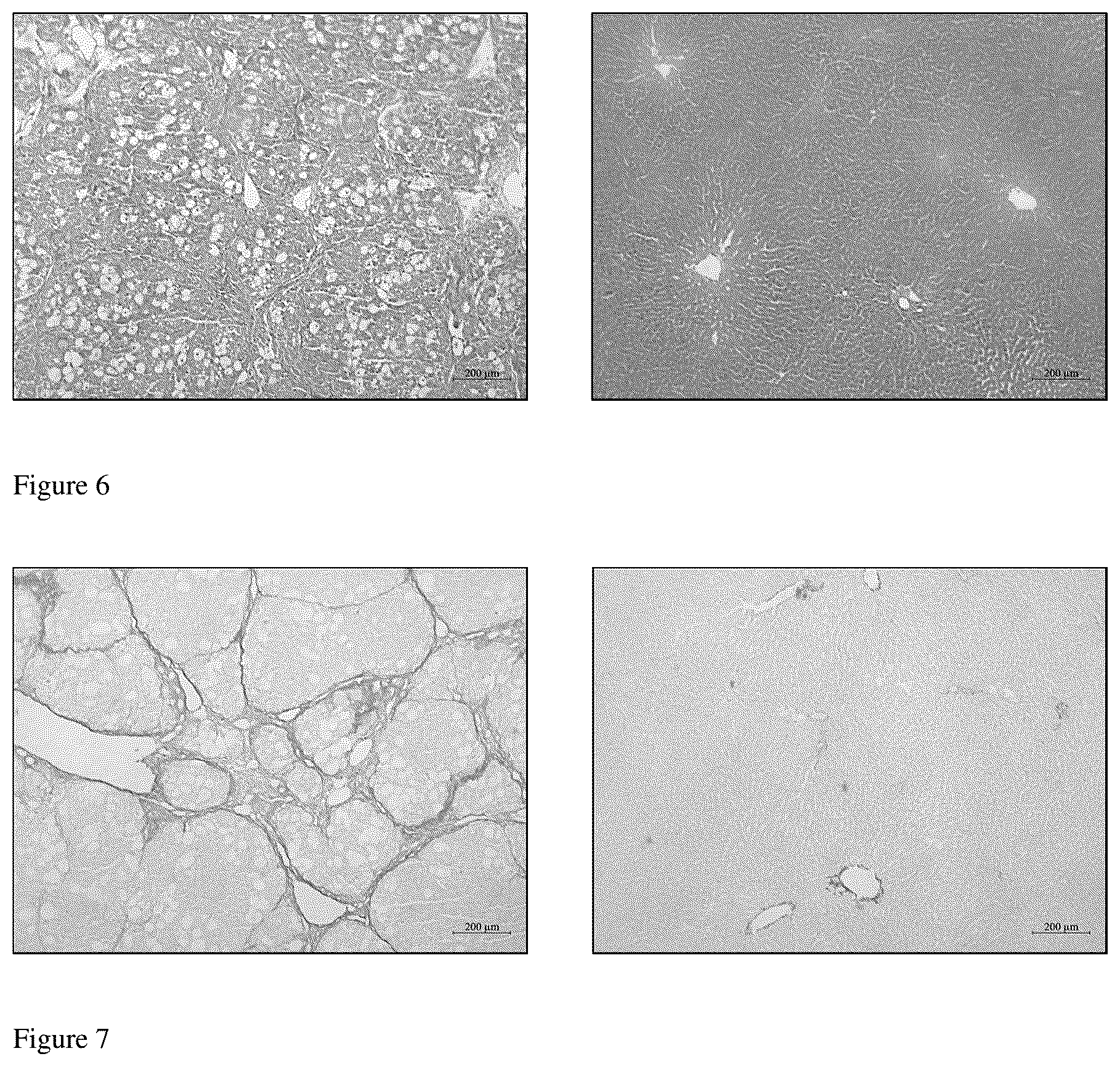 Patent US12396990 Figure 3 – Application of 5-hydroxytryptamine receptor 1A in preparing drug for portal hypertension