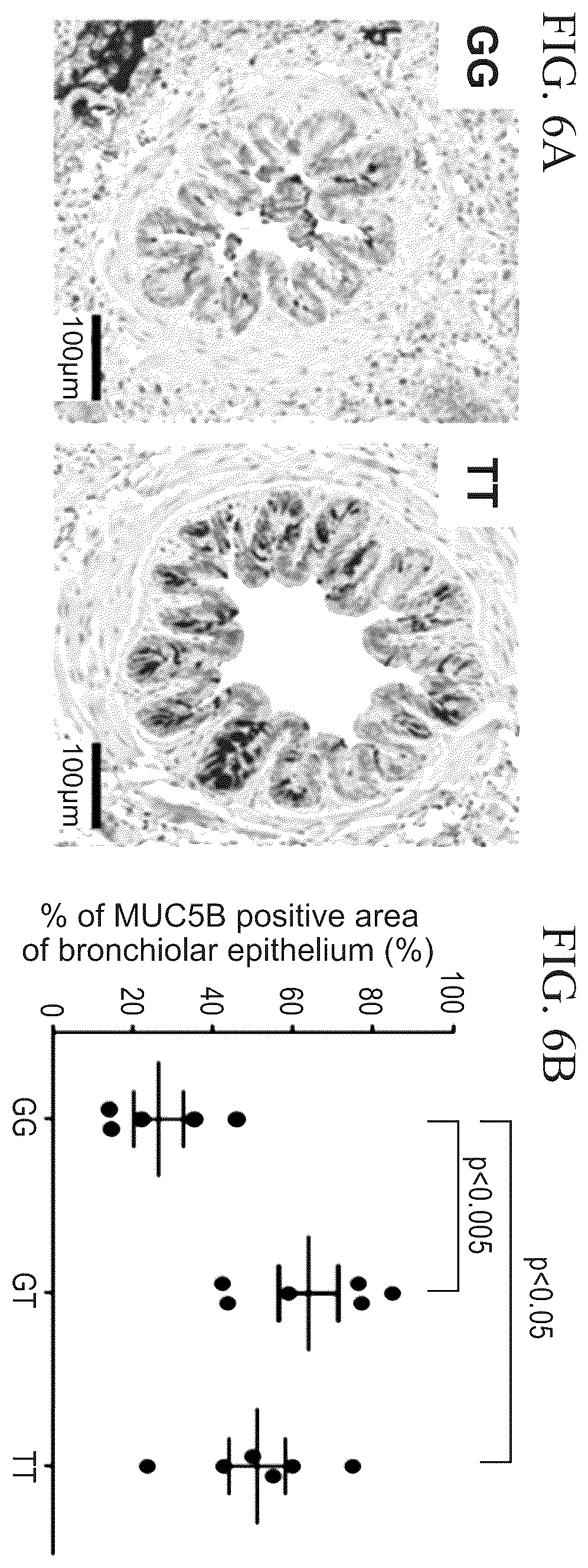 Patent US12396991 Figure 6 – Biomarkers for the diagnosis and treatment of fibrotic lung disease