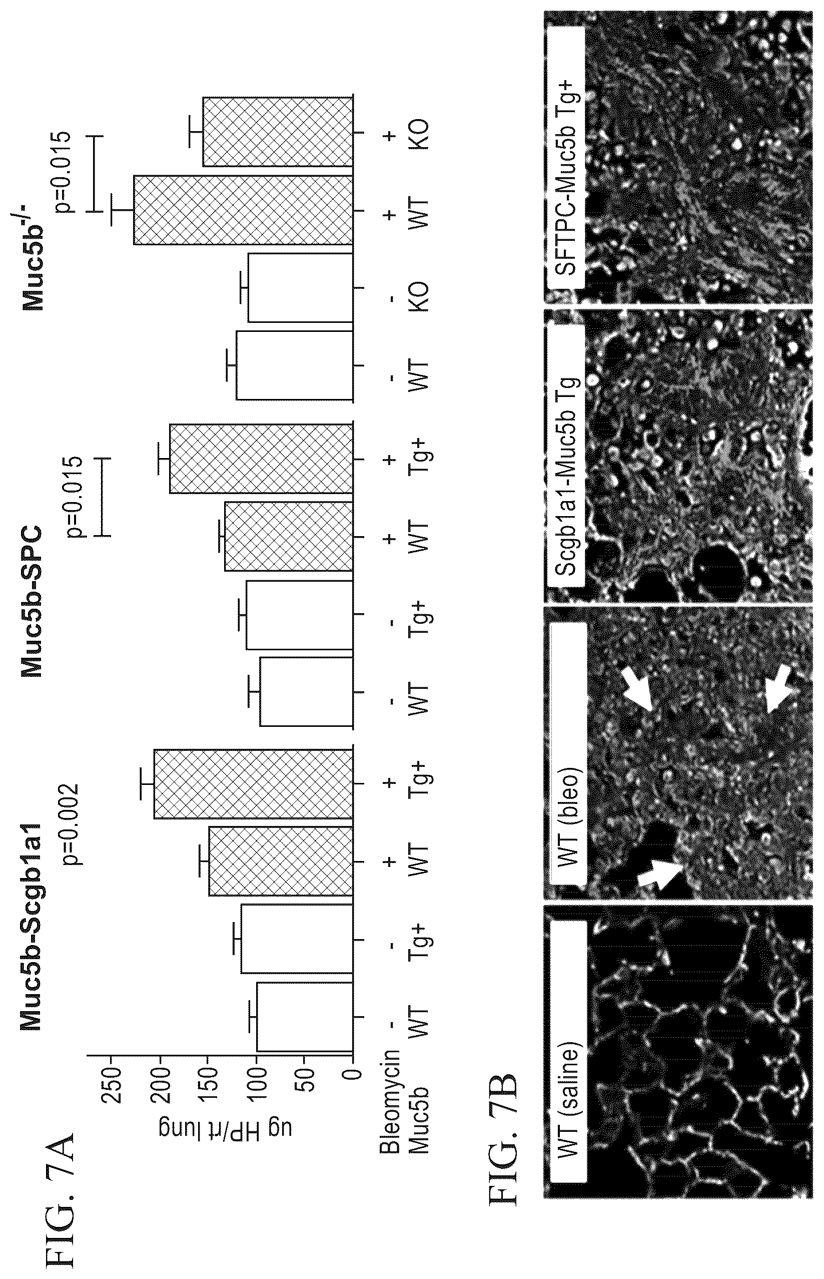Patent US12396991 Figure 7 – Biomarkers for the diagnosis and treatment of fibrotic lung disease