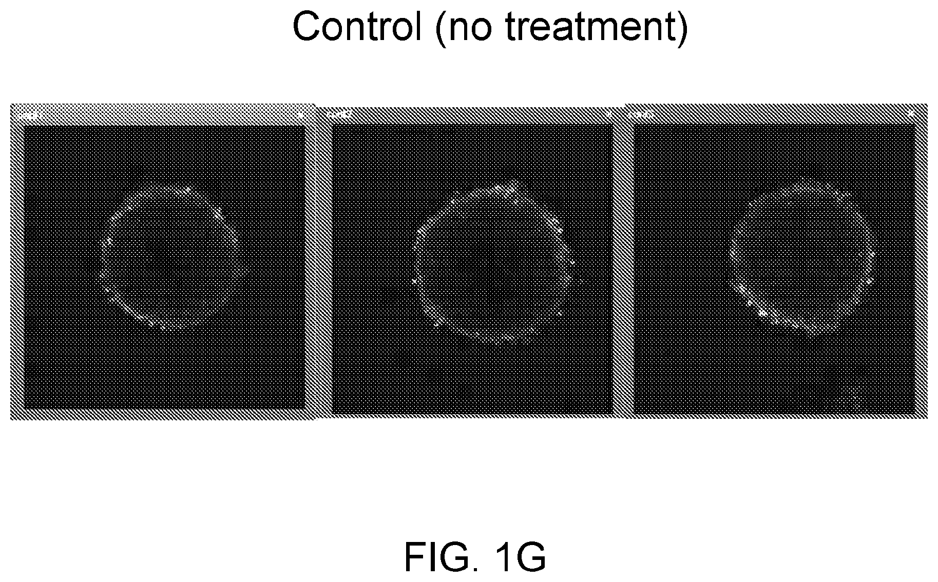 Patent US12396996 Figure 7 – Compounds, pharmaceutical compositions, and methods of their use in reversing cancer chemoresistance