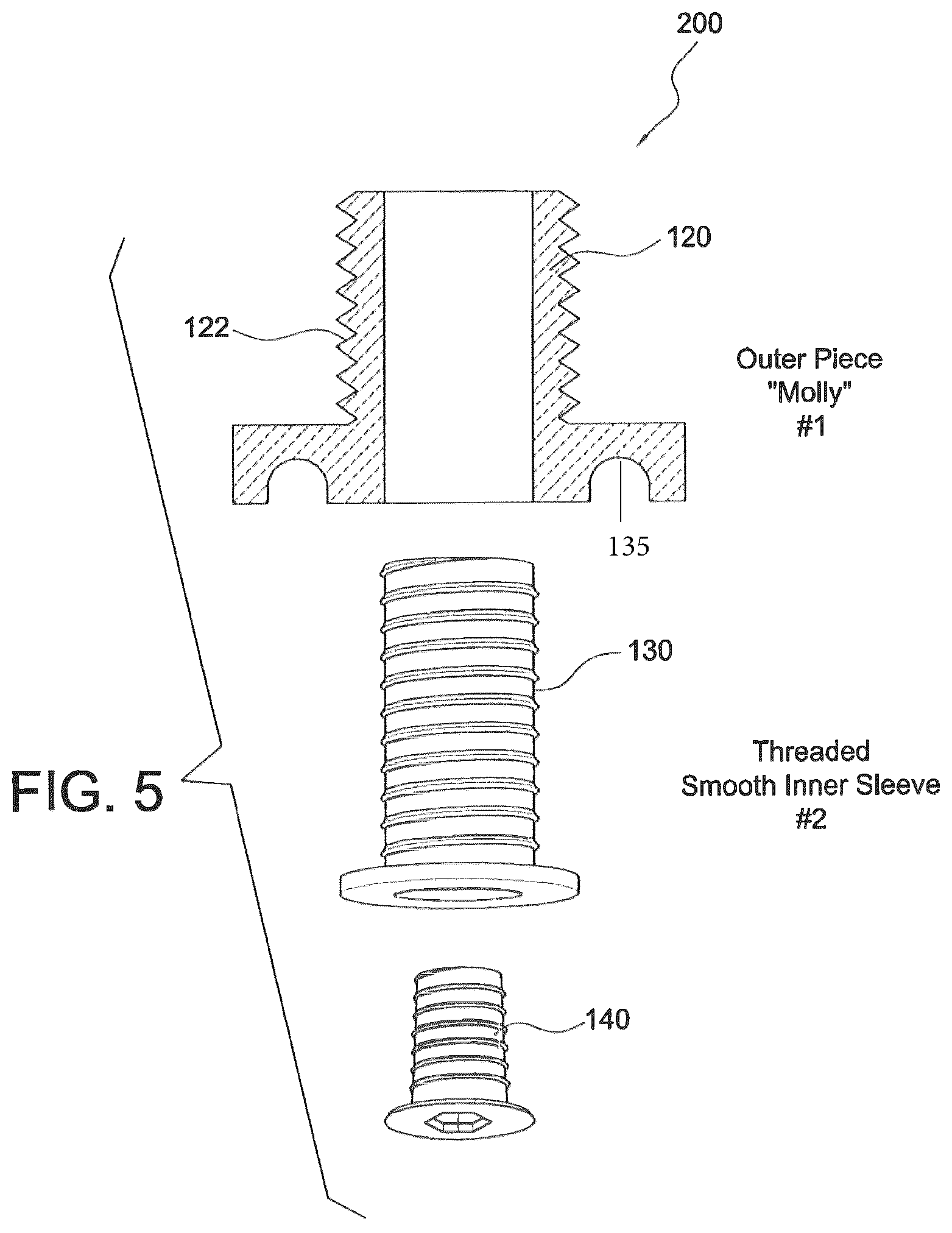 Patent US12403000 Figure 2 – Ligament fixation device and method
