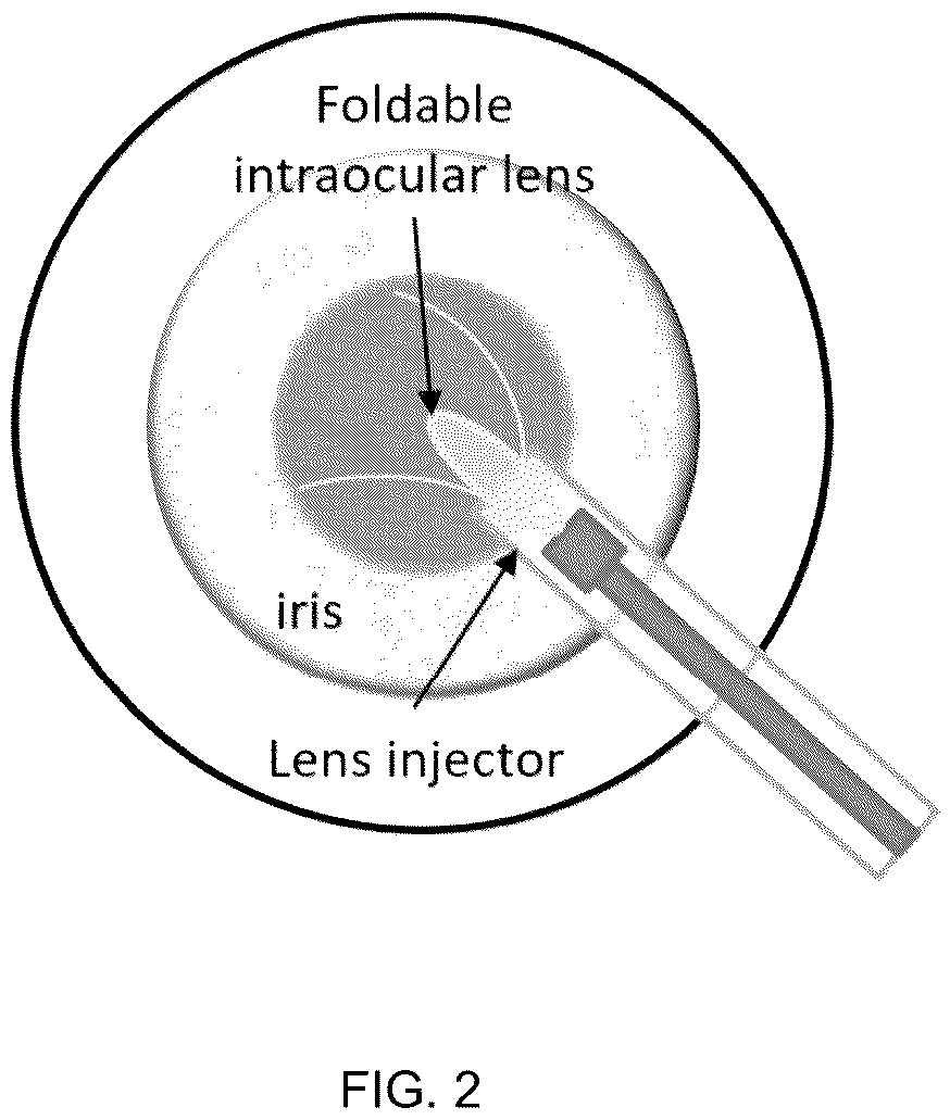 Patent US12403001 Figure 2 – Lens for use in a human or animal body, and production methods thereof