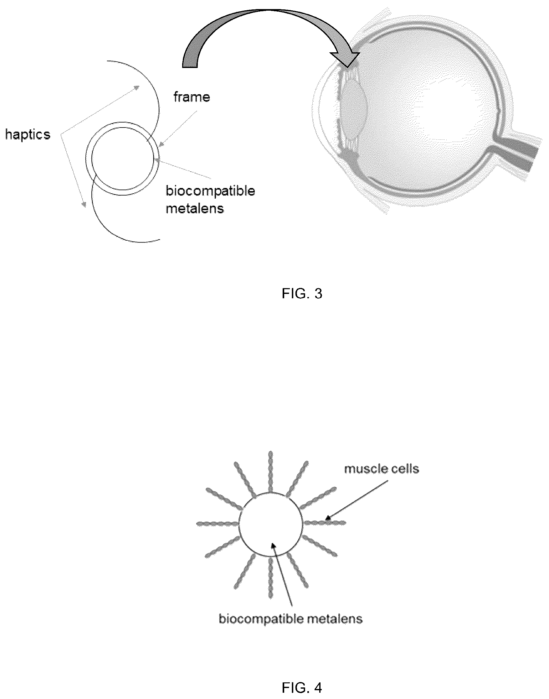 Patent US12403001 Figure 3 – Lens for use in a human or animal body, and production methods thereof