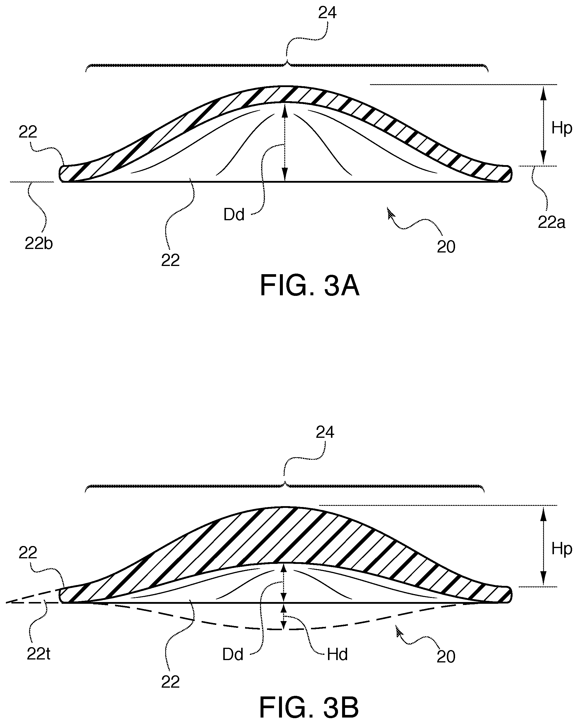 Patent US12403003 Figure 2 – Tympanic membrane patch and loading vehicle