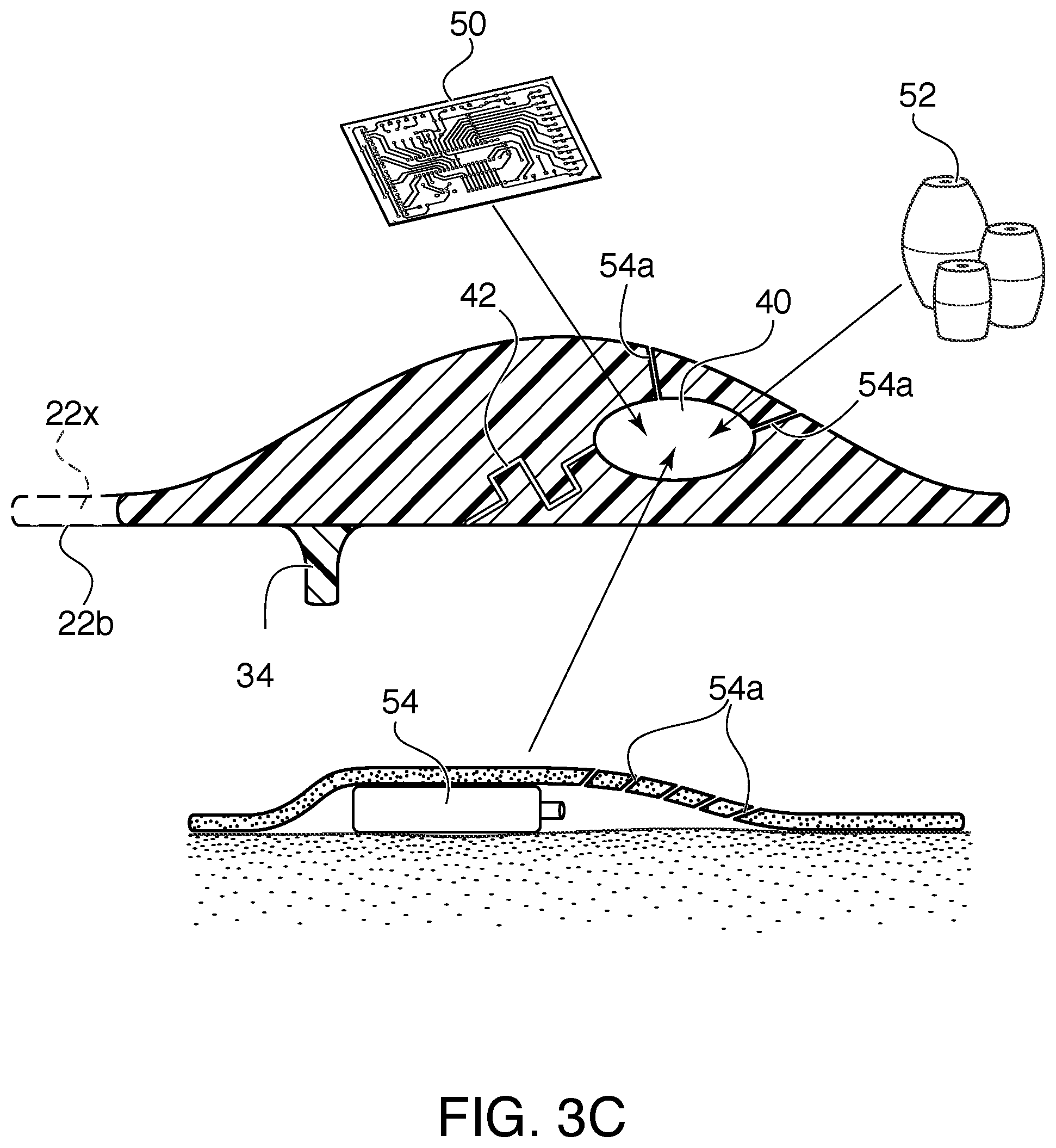 Patent US12403003 Figure 3 – Tympanic membrane patch and loading vehicle