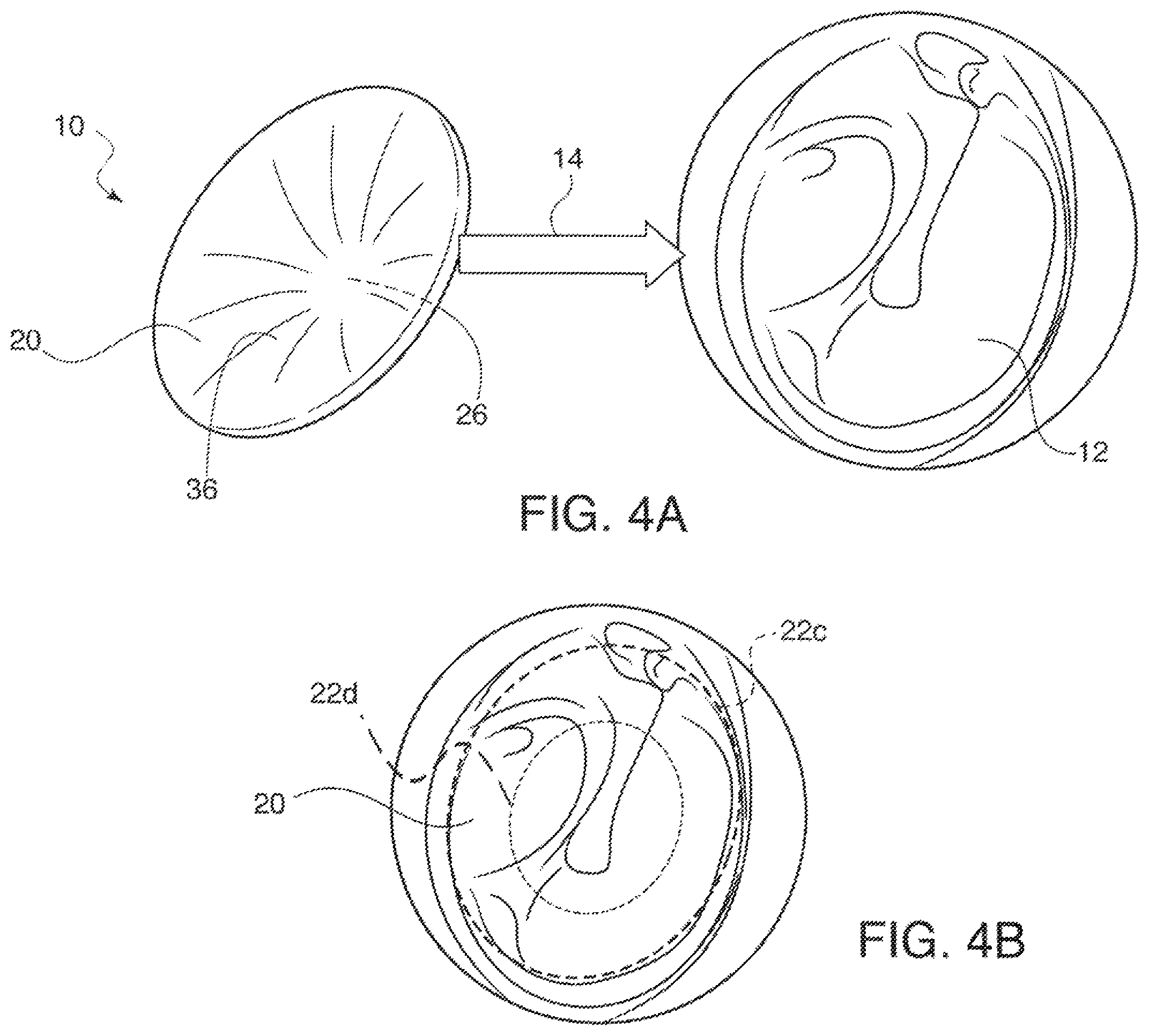 Patent US12403003 Figure 4 – Tympanic membrane patch and loading vehicle