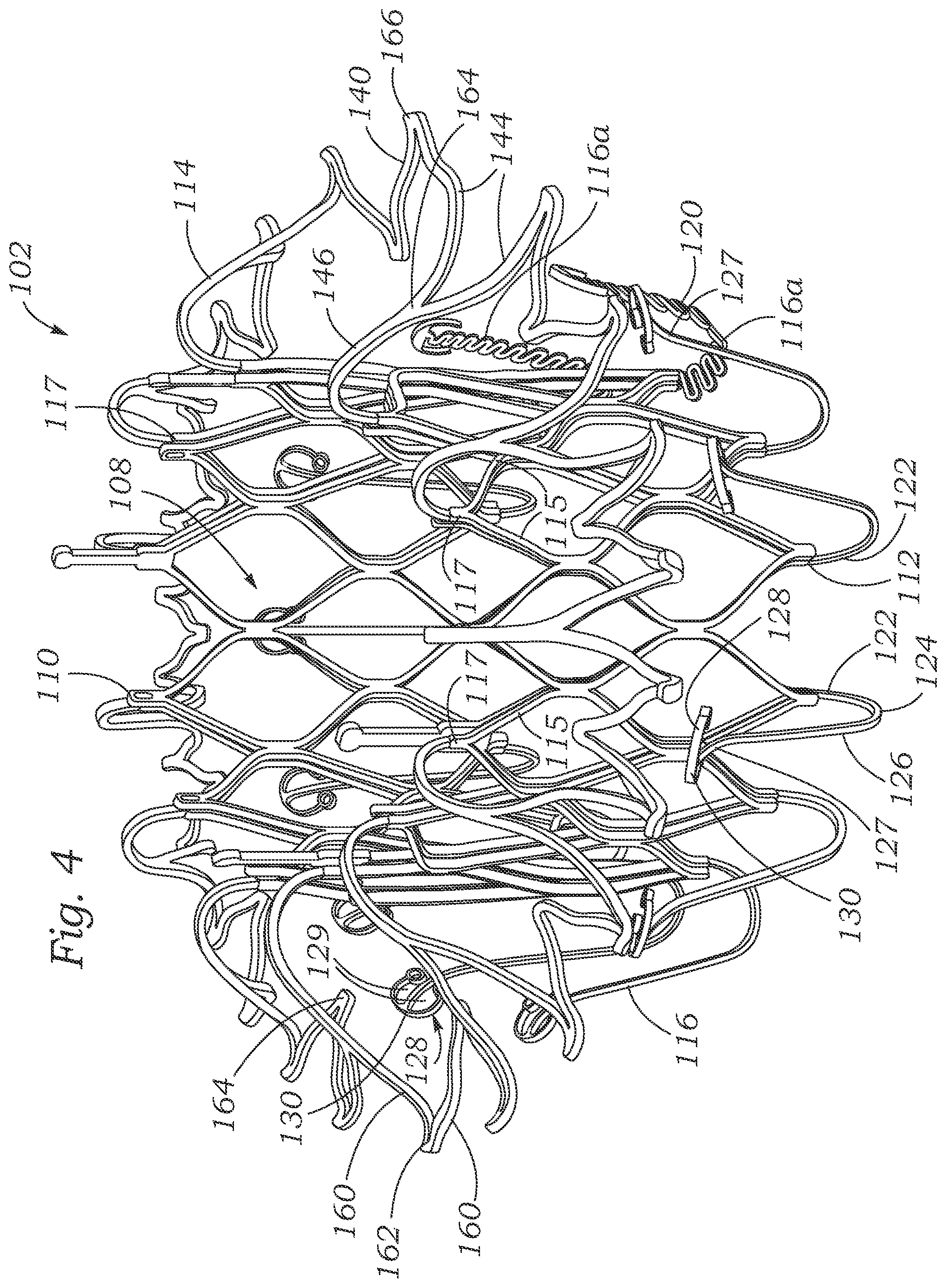 Patent US12403004 Figure 3 – Method for replacing a tricuspid valve