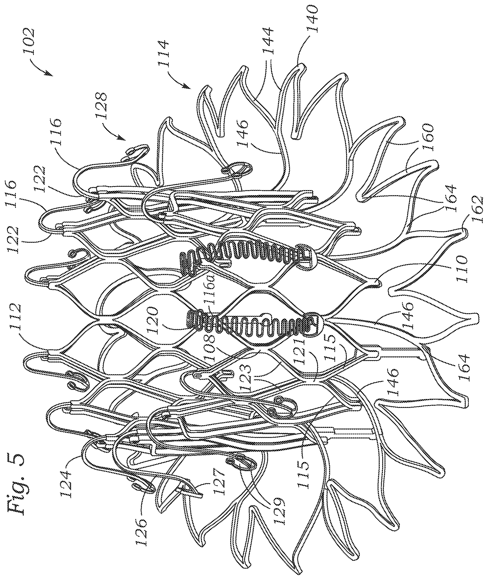 Patent US12403004 Figure 4 – Method for replacing a tricuspid valve