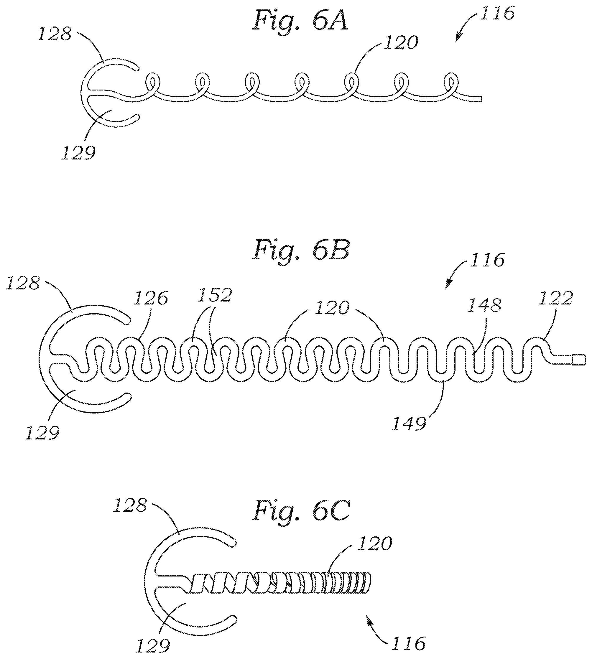 Patent US12403004 Figure 5 – Method for replacing a tricuspid valve