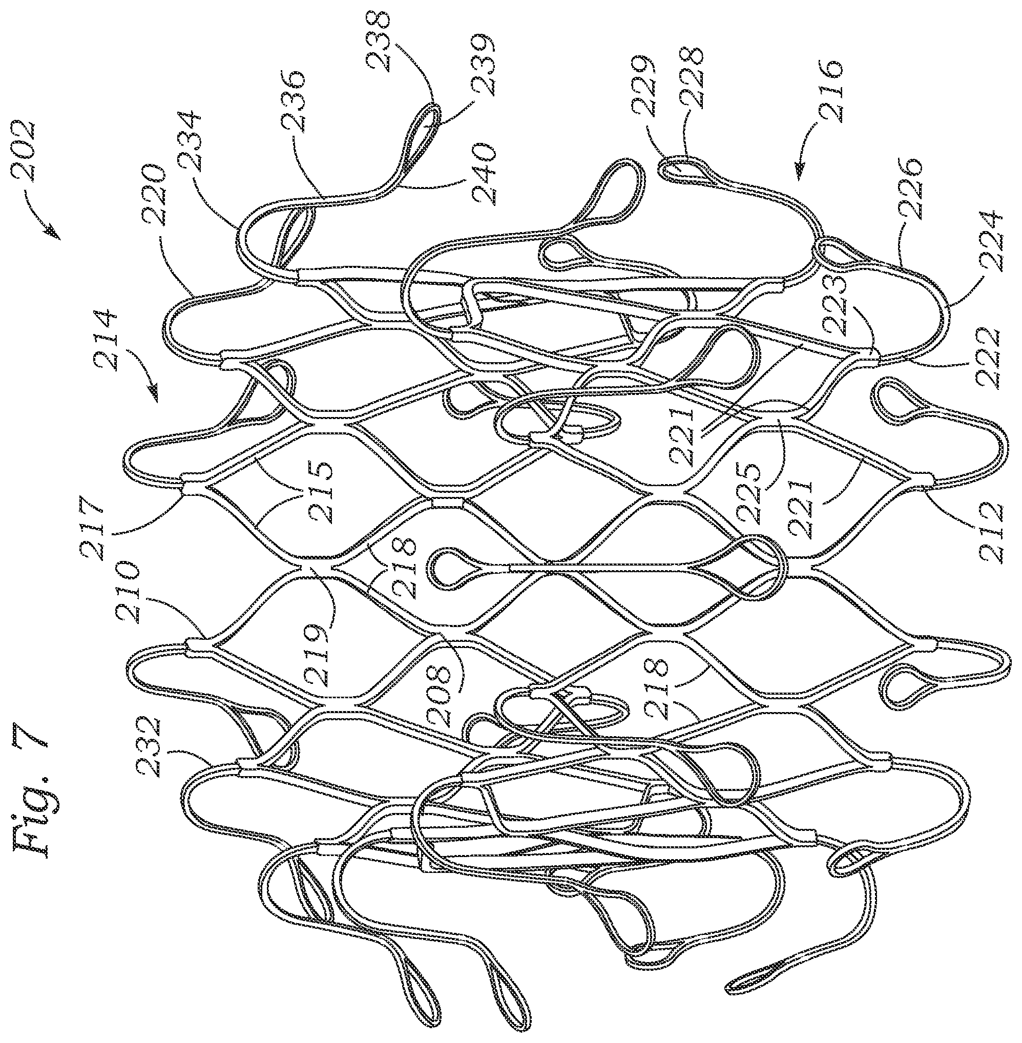 Patent US12403004 Figure 6 – Method for replacing a tricuspid valve