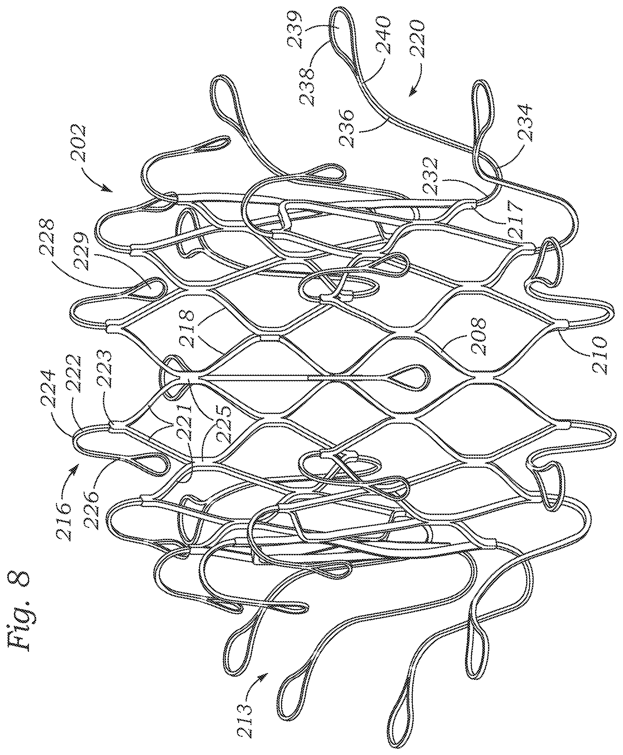 Patent US12403004 Figure 7 – Method for replacing a tricuspid valve