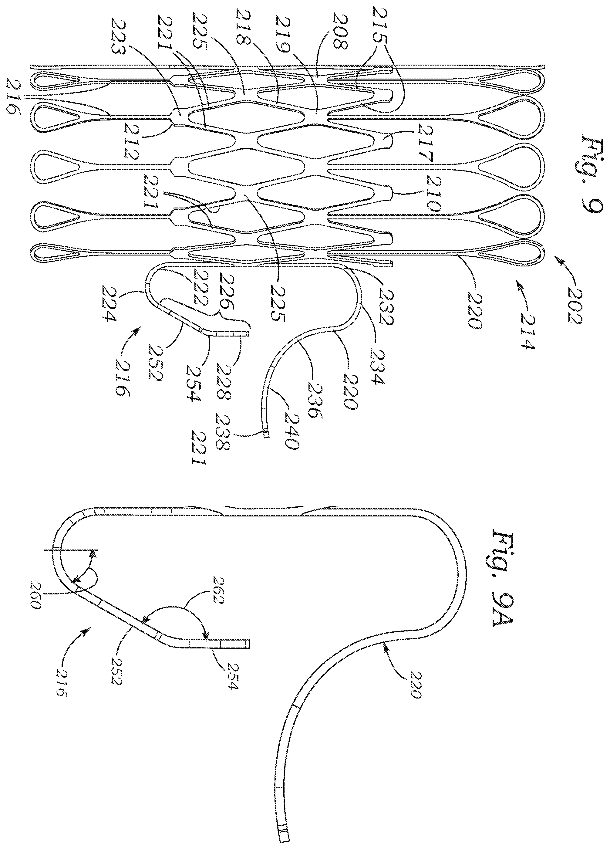 Patent US12403004 Figure 8 – Method for replacing a tricuspid valve