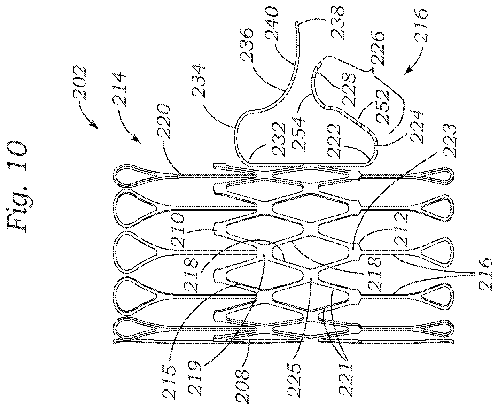 Patent US12403004 Figure 9 – Method for replacing a tricuspid valve
