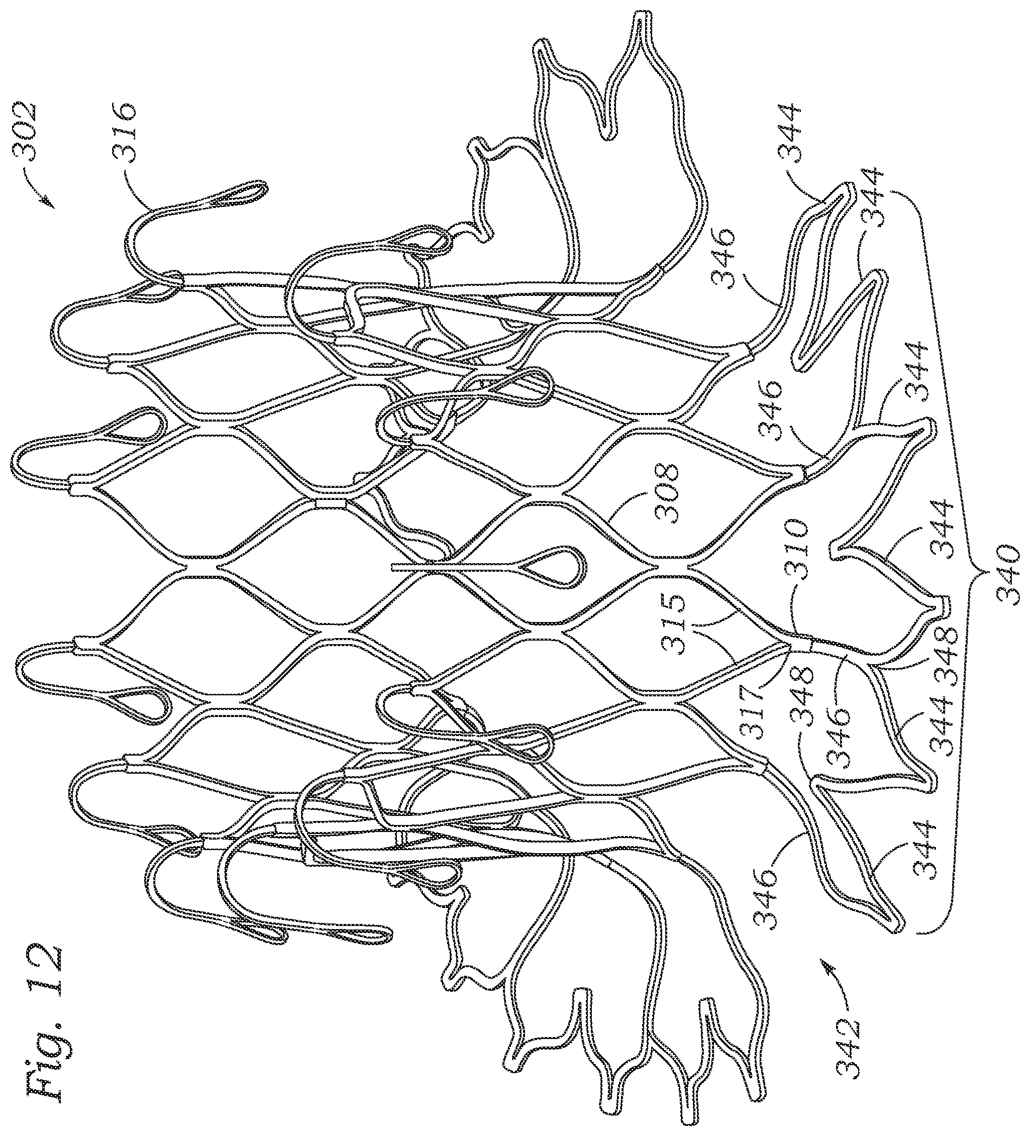 Patent US12403004 Figure 11 – Method for replacing a tricuspid valve