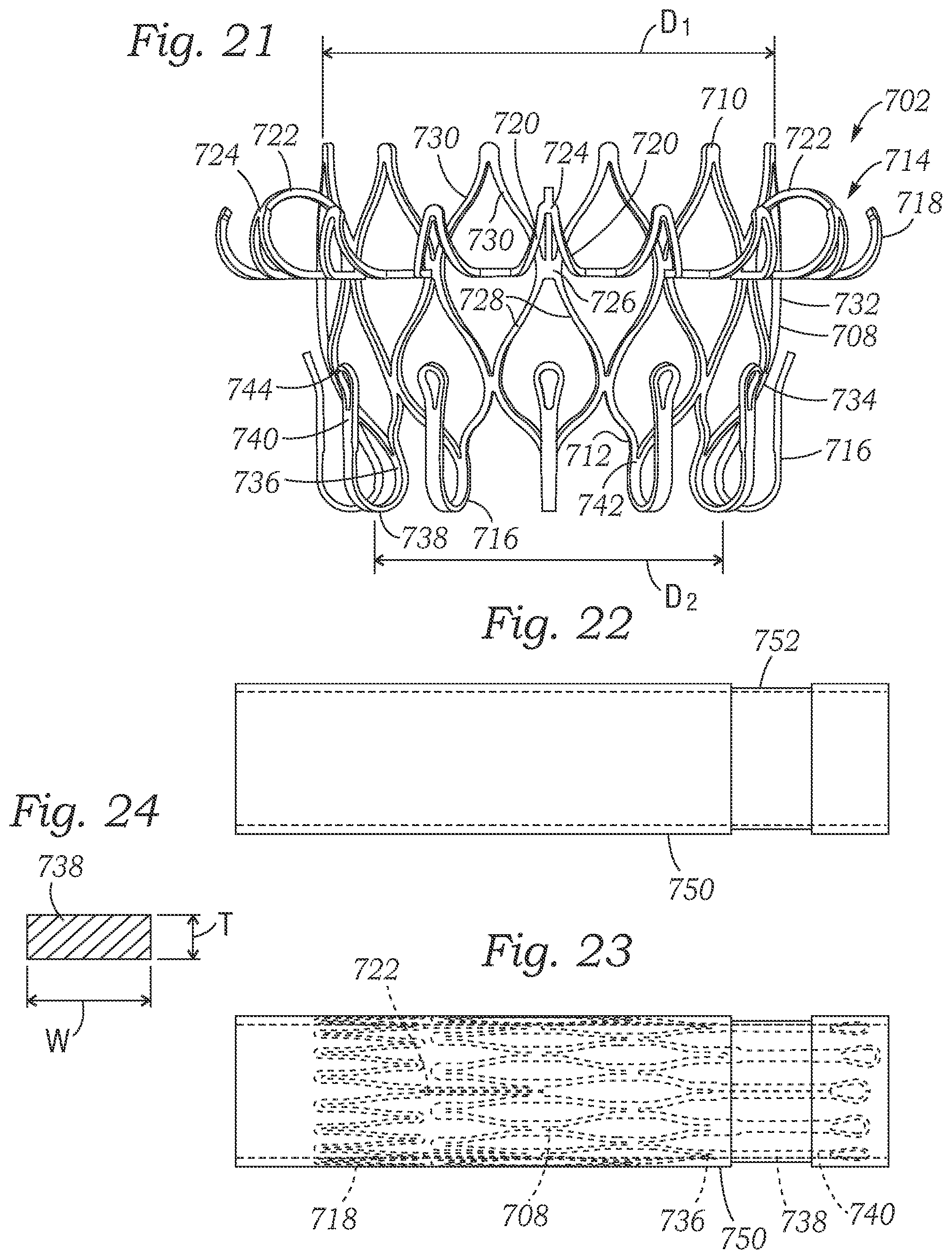 Patent US12403004 Figure 20 – Method for replacing a tricuspid valve