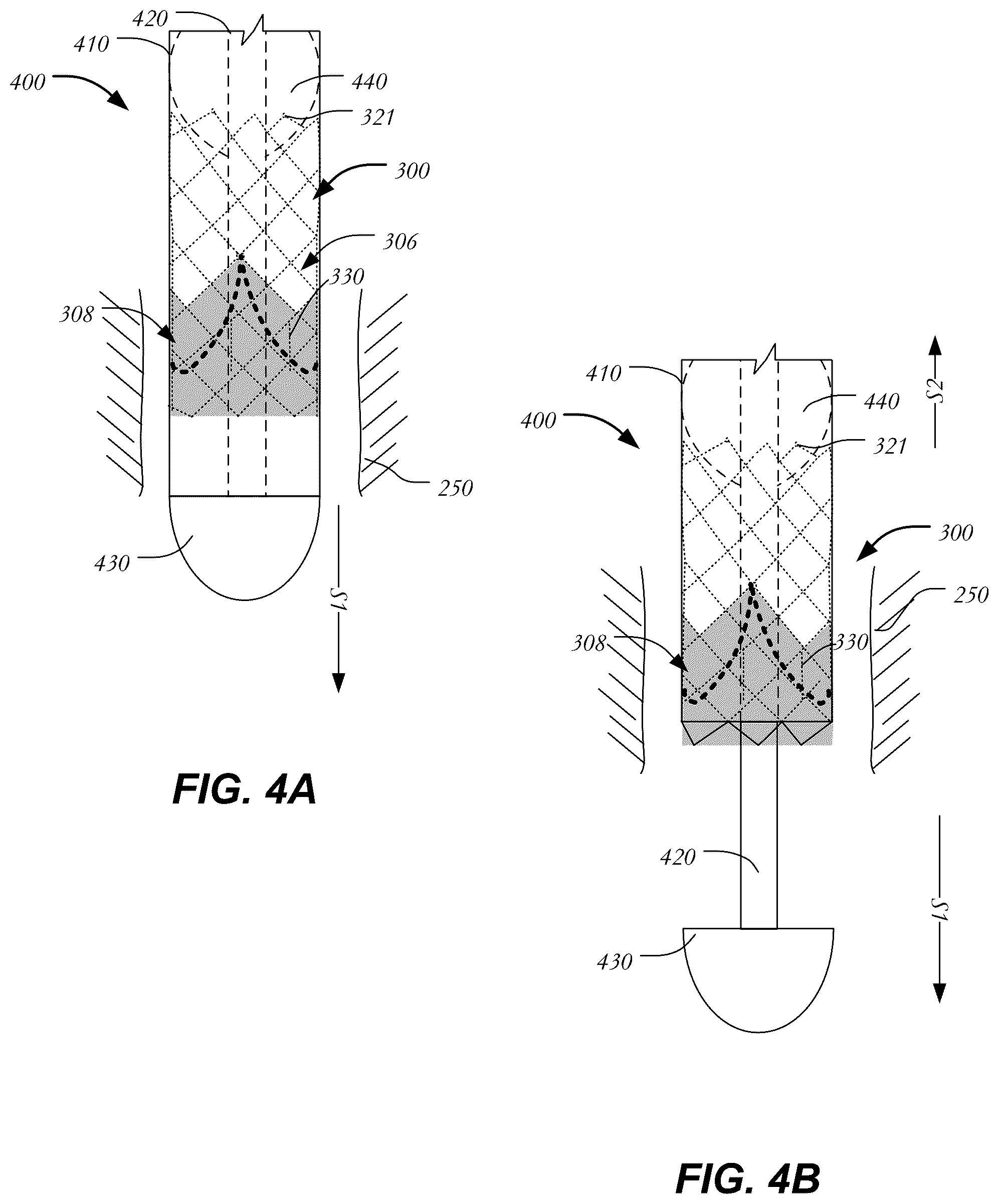 Patent US12403005 Figure 5 – Bowed runners and corresponding valve assemblies for paravalvular leak protection
