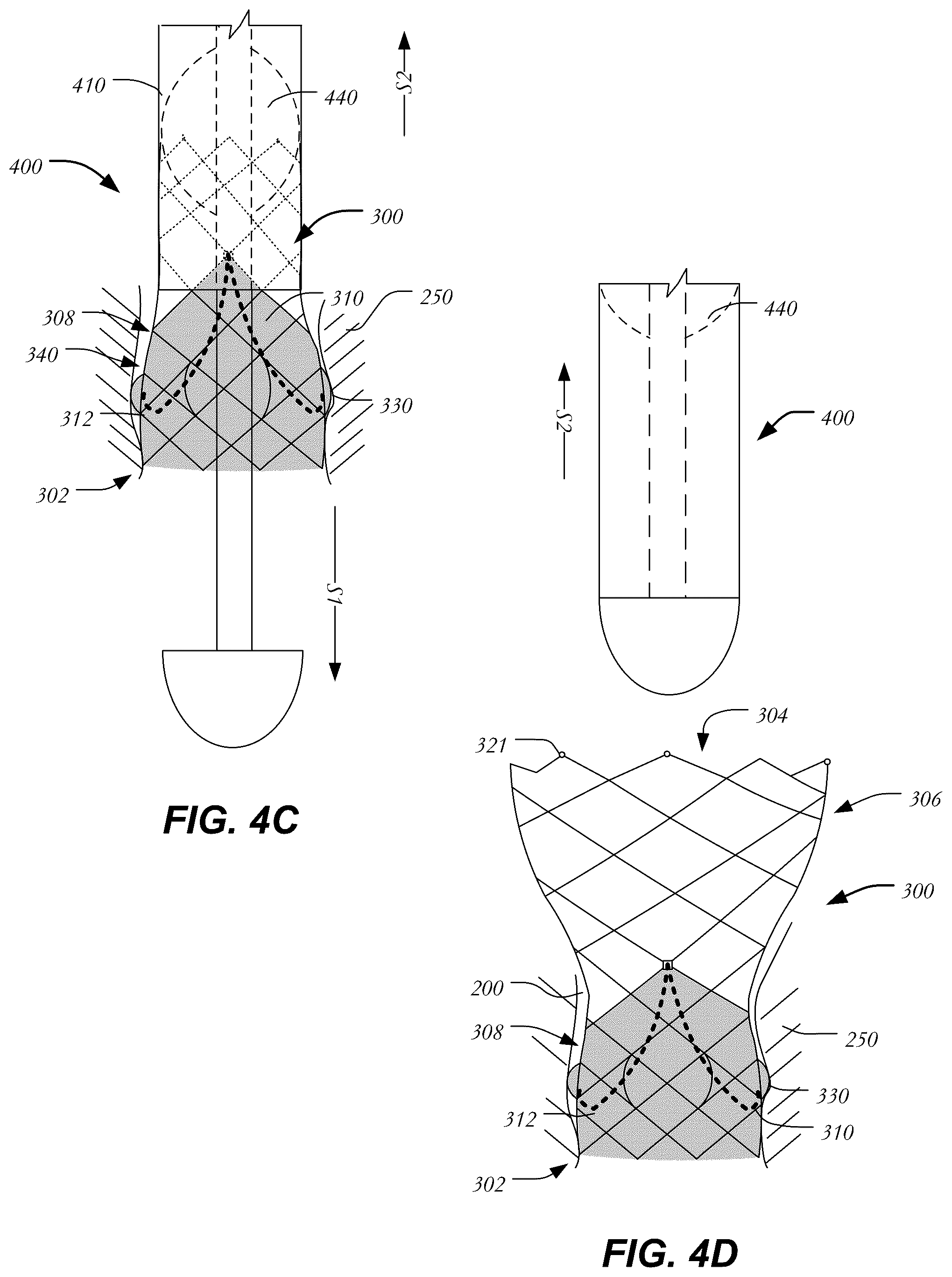 Patent US12403005 Figure 6 – Bowed runners and corresponding valve assemblies for paravalvular leak protection